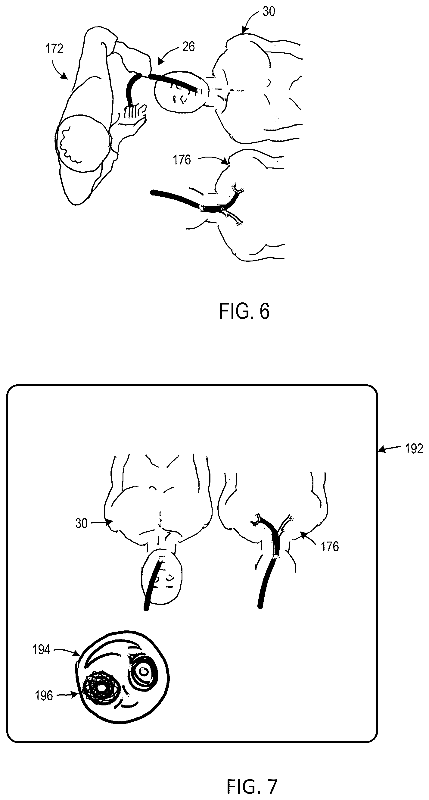 Patent US12472007 Figure 6 – Viewing system for use in a surgical environment