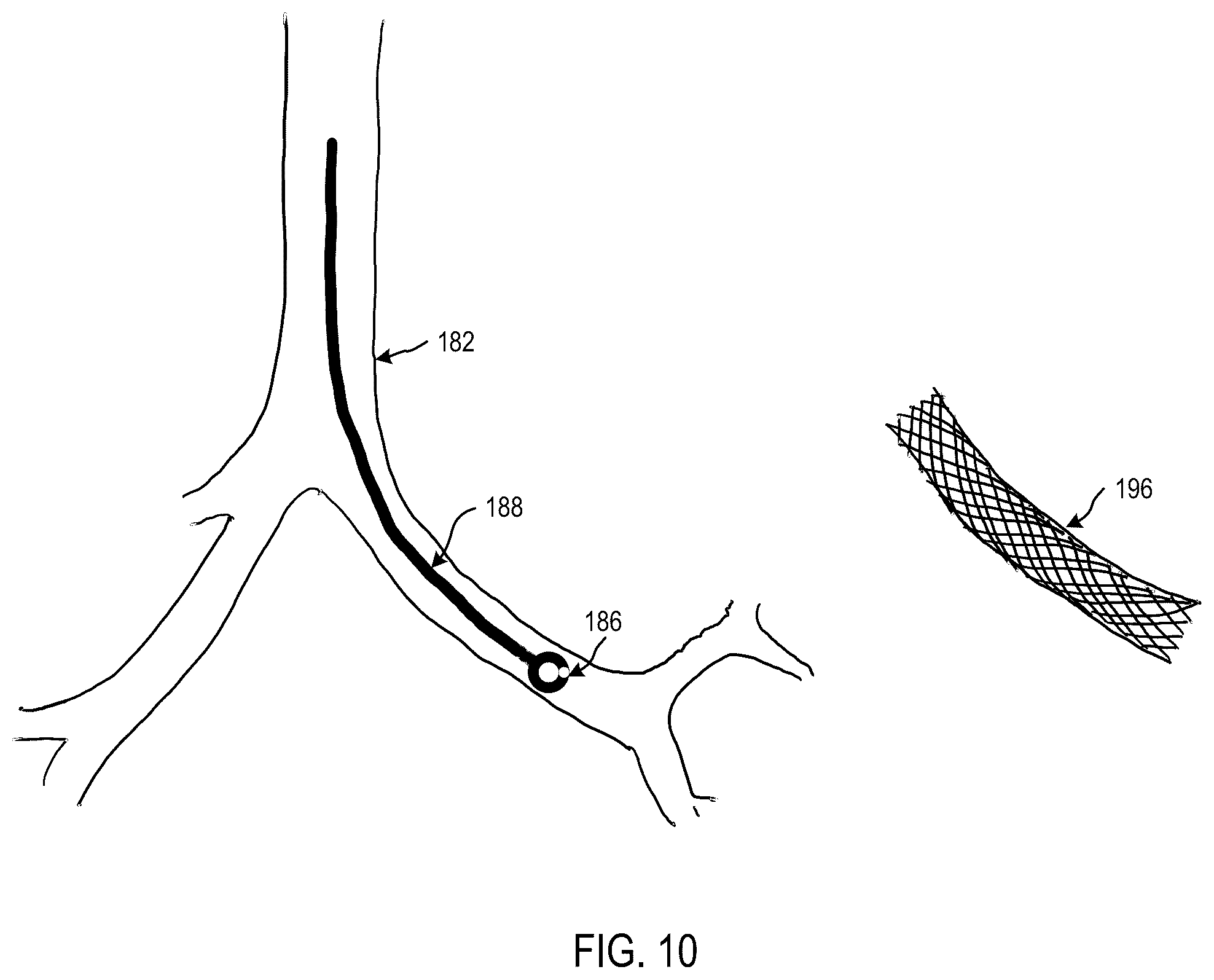 Patent US12472007 Figure 8 – Viewing system for use in a surgical environment