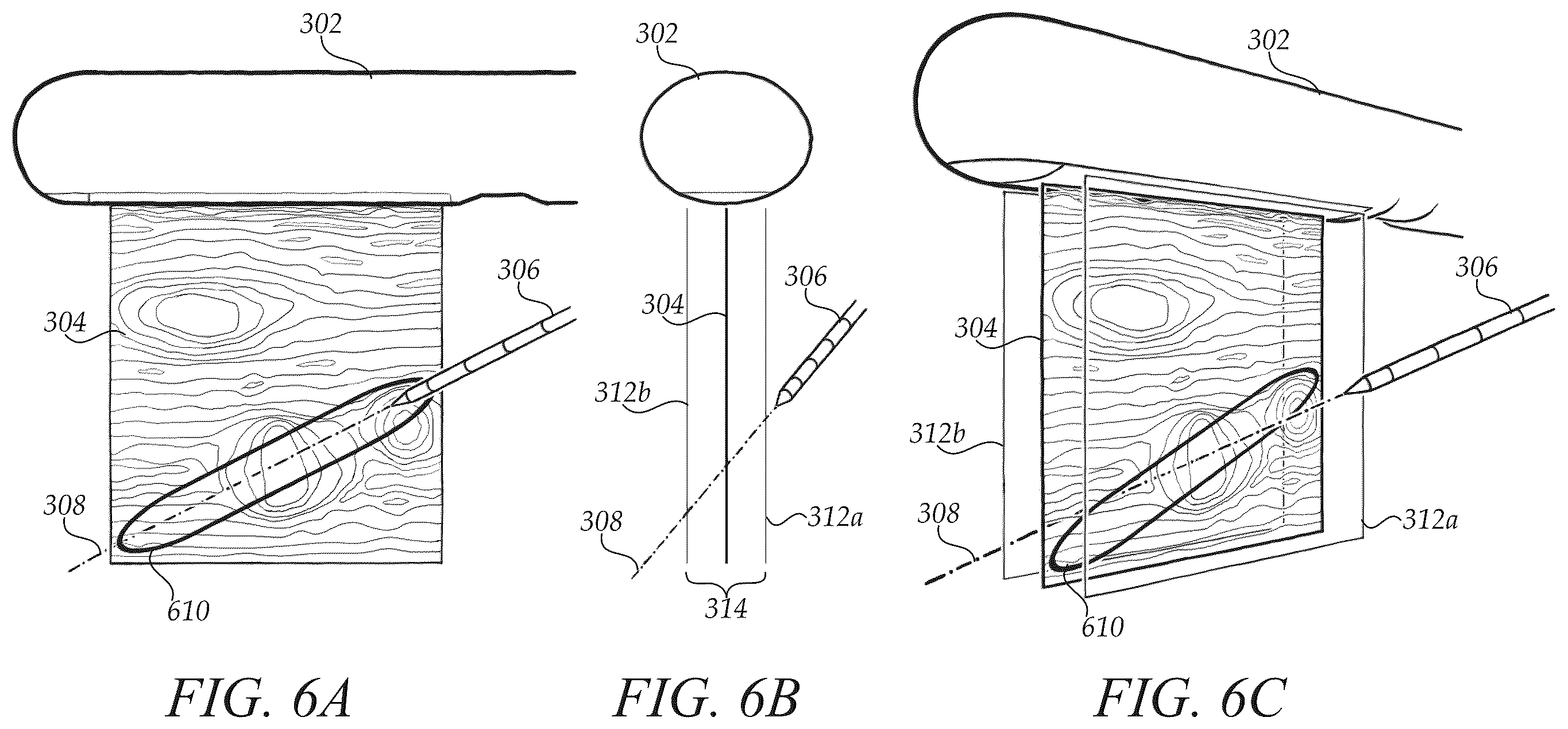 Patent US12472009 Figure 6 – Surgical guidance intersection display