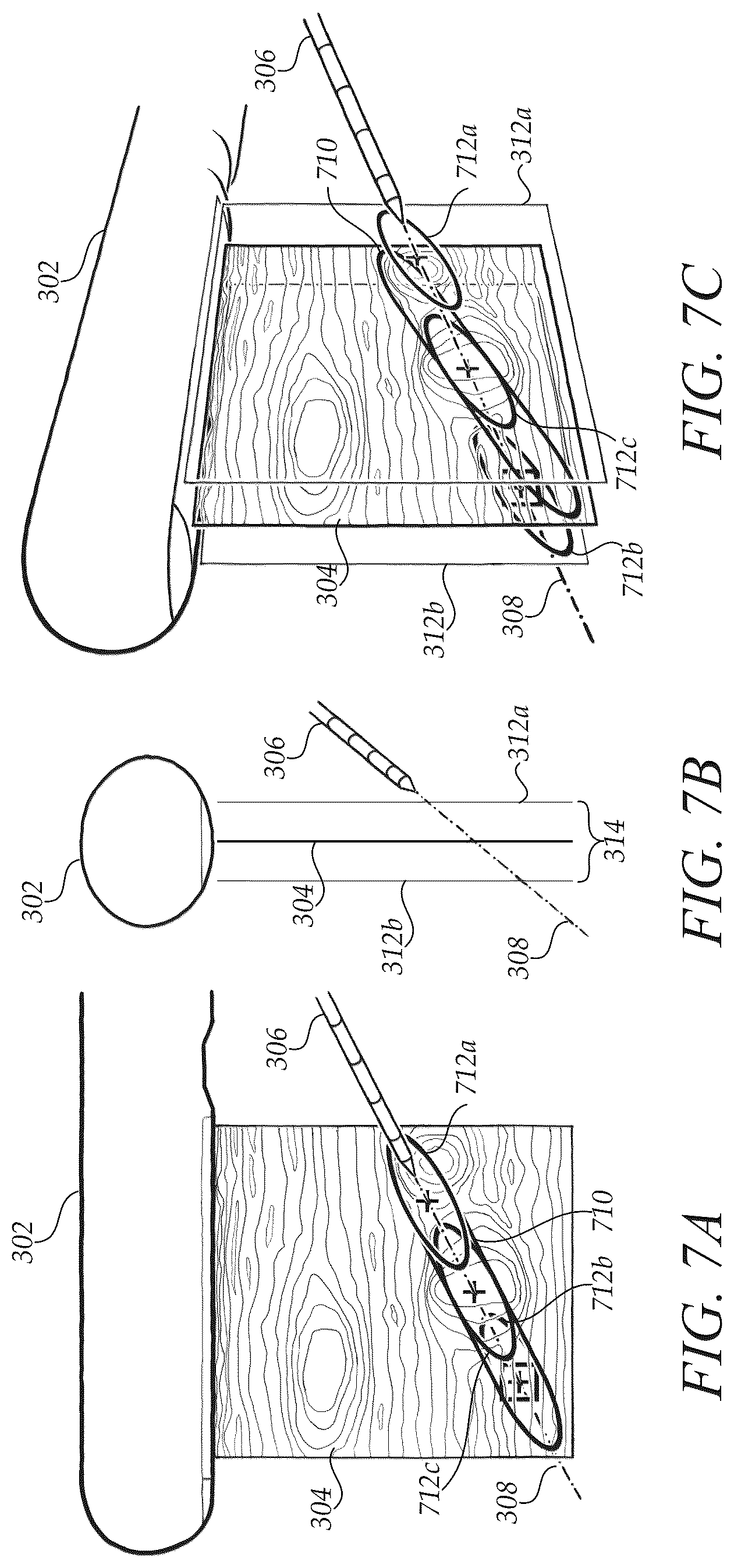 Patent US12472009 Figure 7 – Surgical guidance intersection display