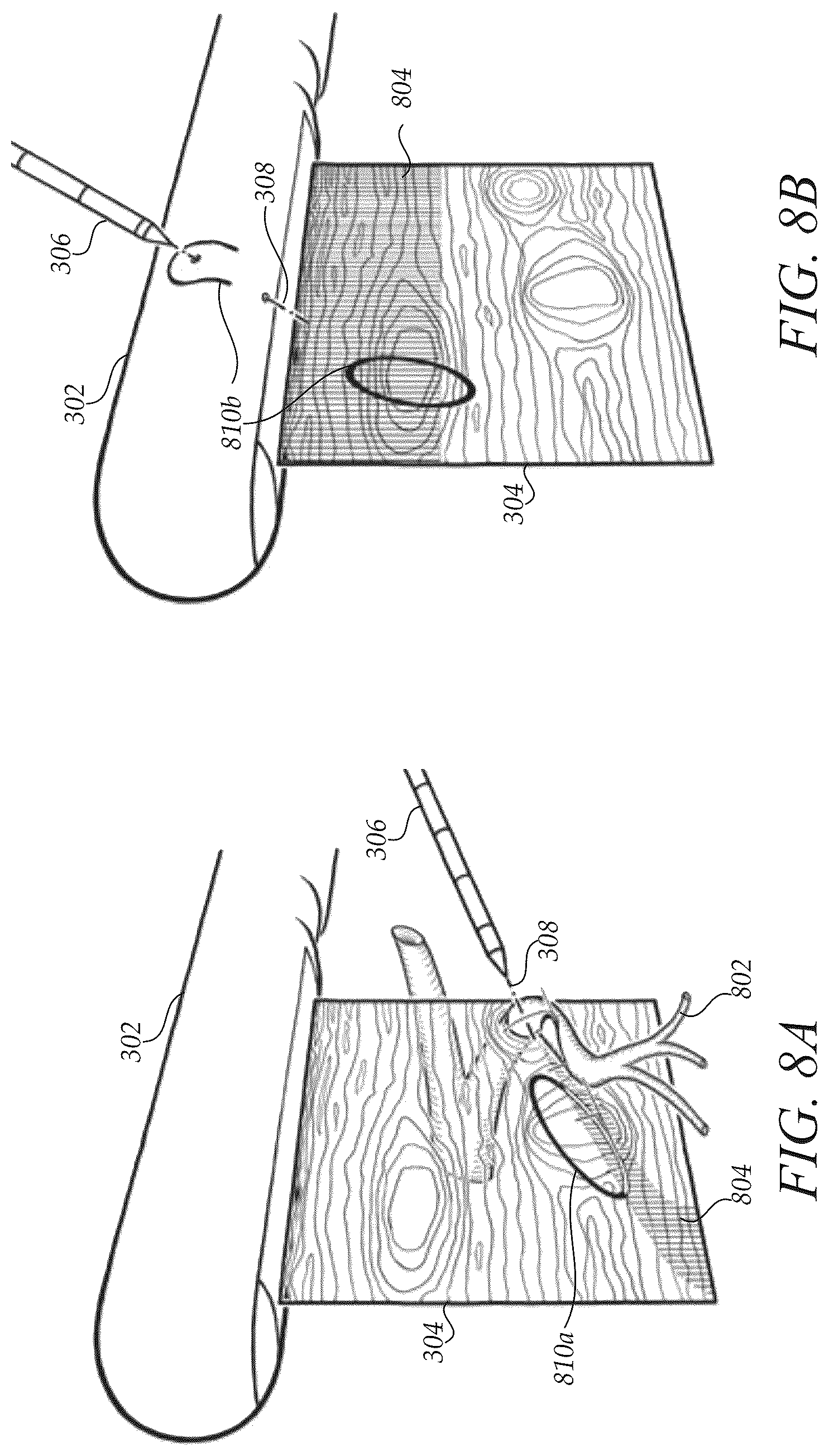 Patent US12472009 Figure 8 – Surgical guidance intersection display