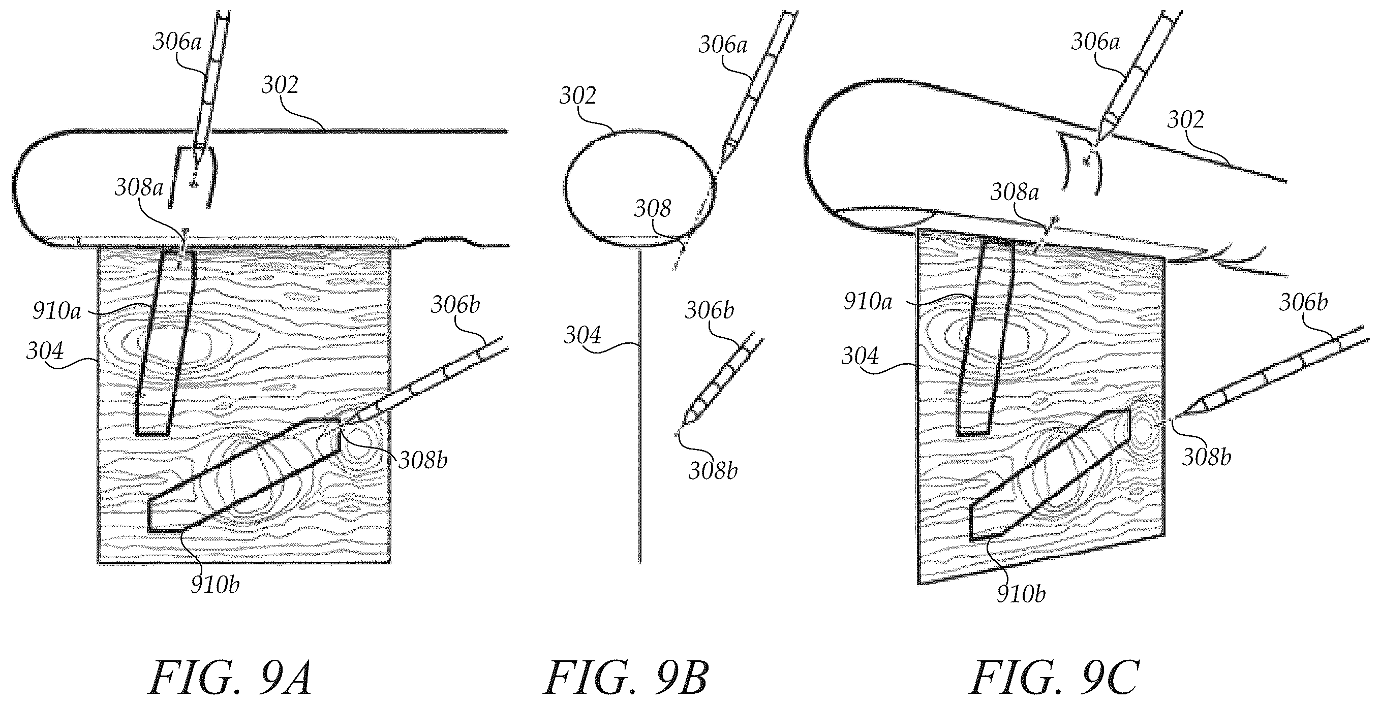 Patent US12472009 Figure 9 – Surgical guidance intersection display
