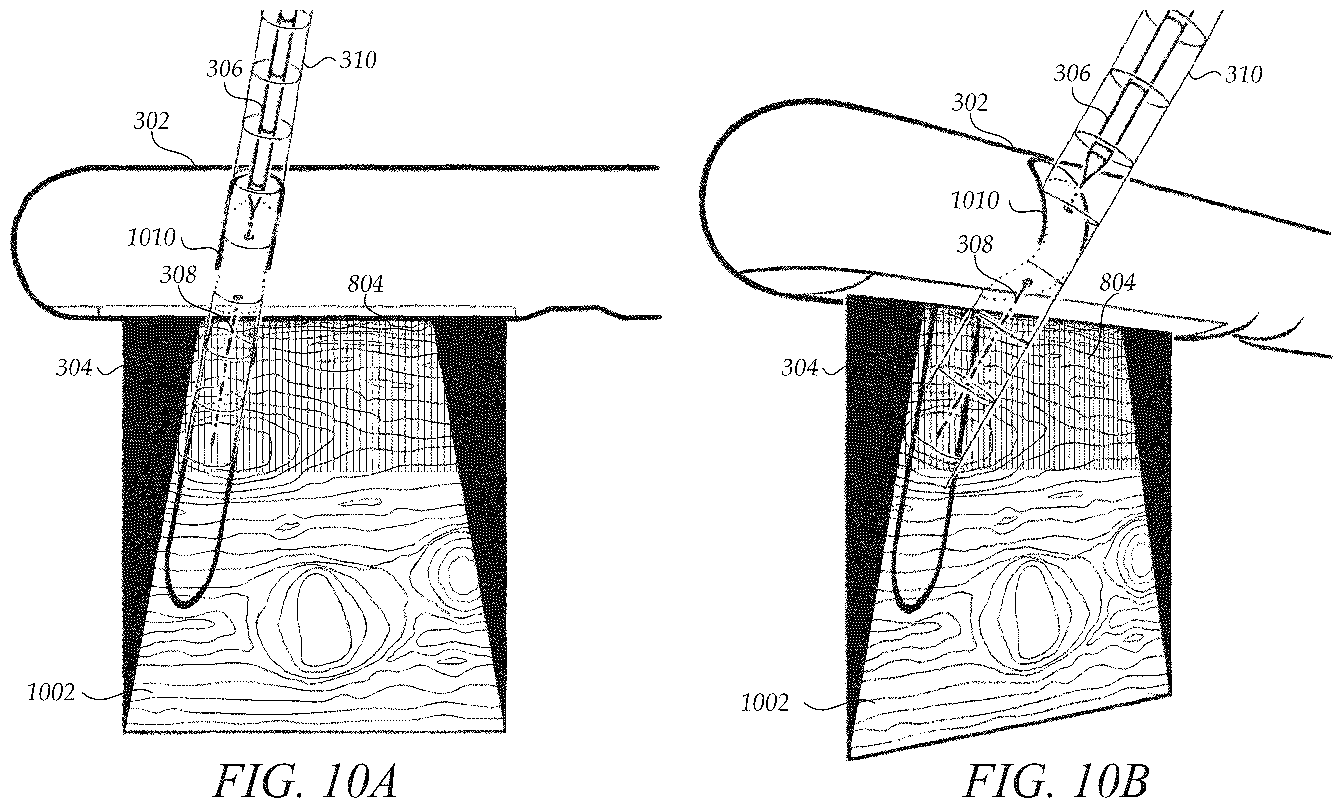 Patent US12472009 Figure 10 – Surgical guidance intersection display