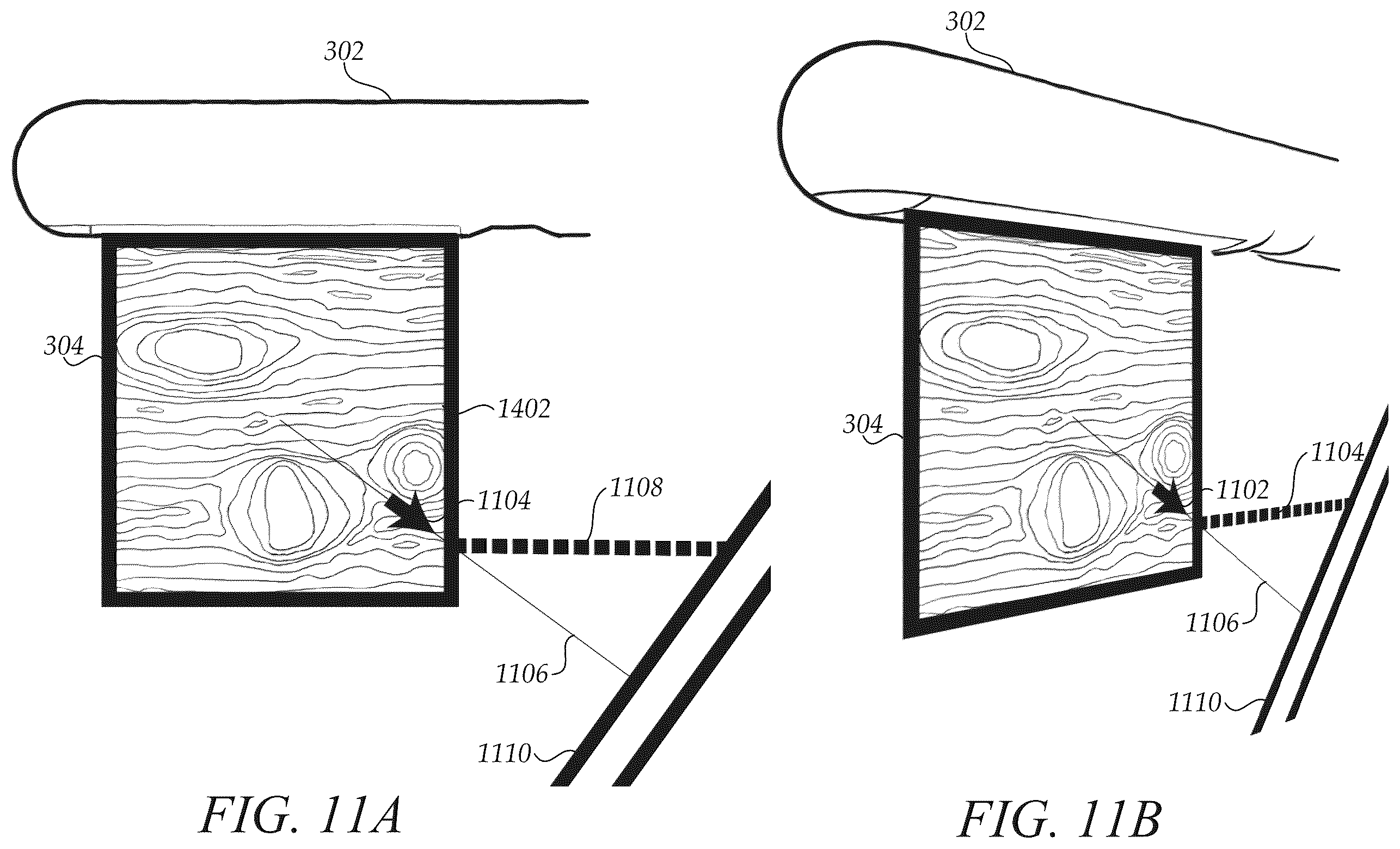Patent US12472009 Figure 11 – Surgical guidance intersection display