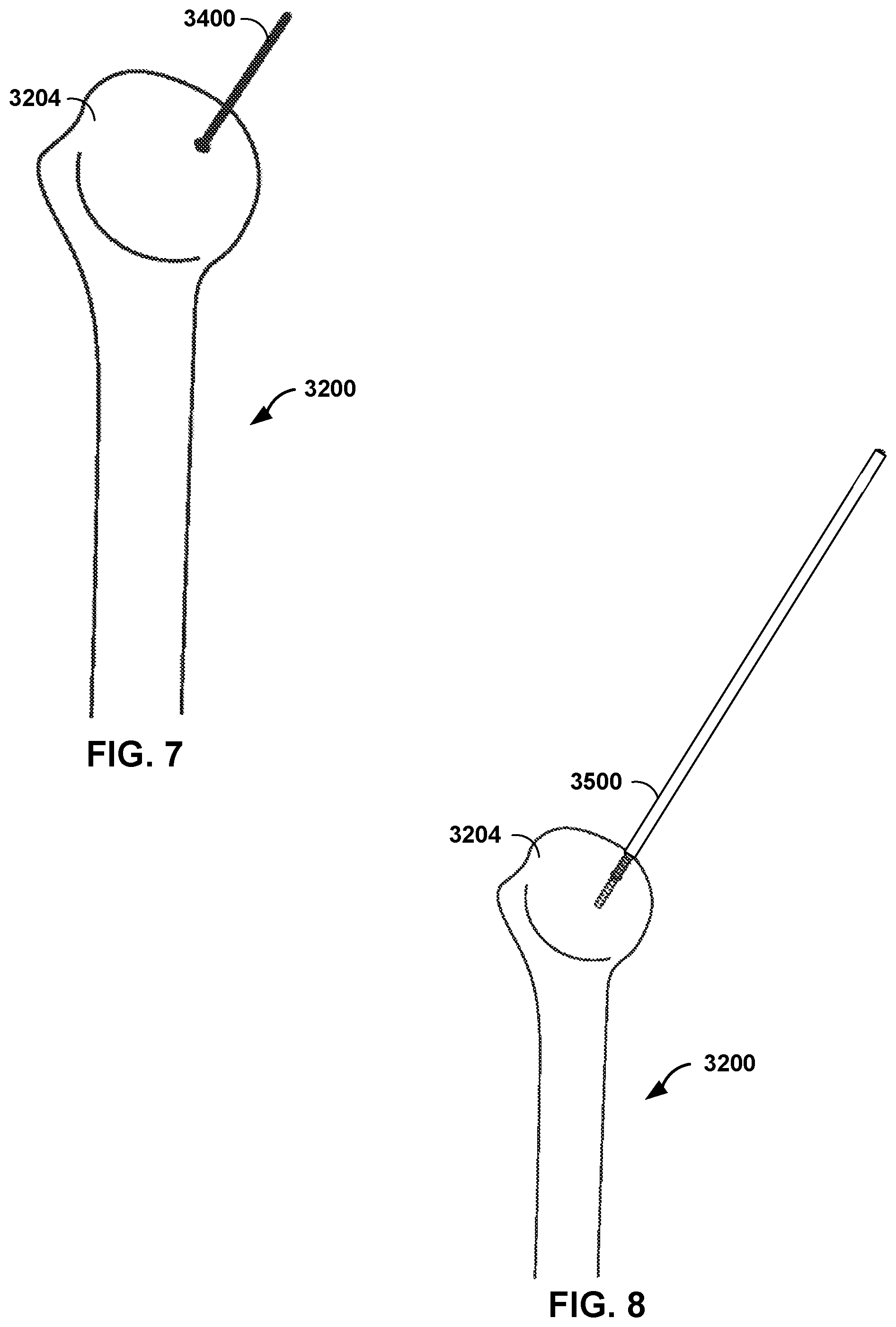 Patent US12472013 Figure 7 – Virtual guidance for correcting surgical pin installation