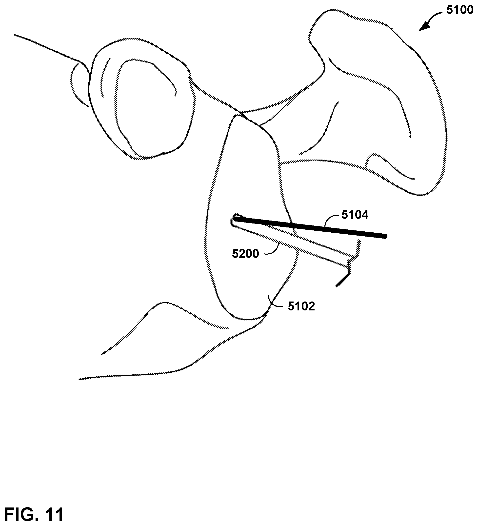 Patent US12472013 Figure 9 – Virtual guidance for correcting surgical pin installation