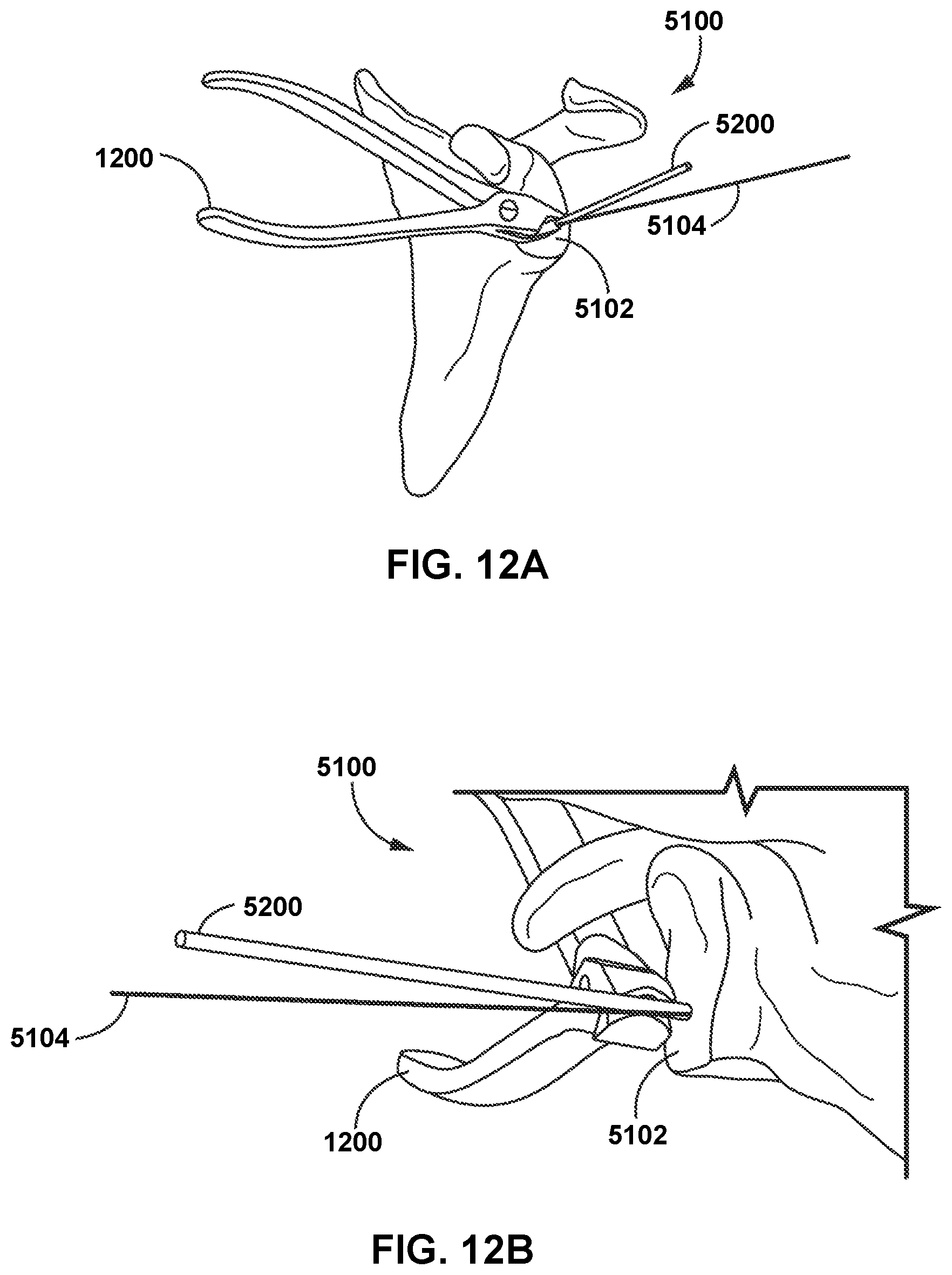 Patent US12472013 Figure 10 – Virtual guidance for correcting surgical pin installation