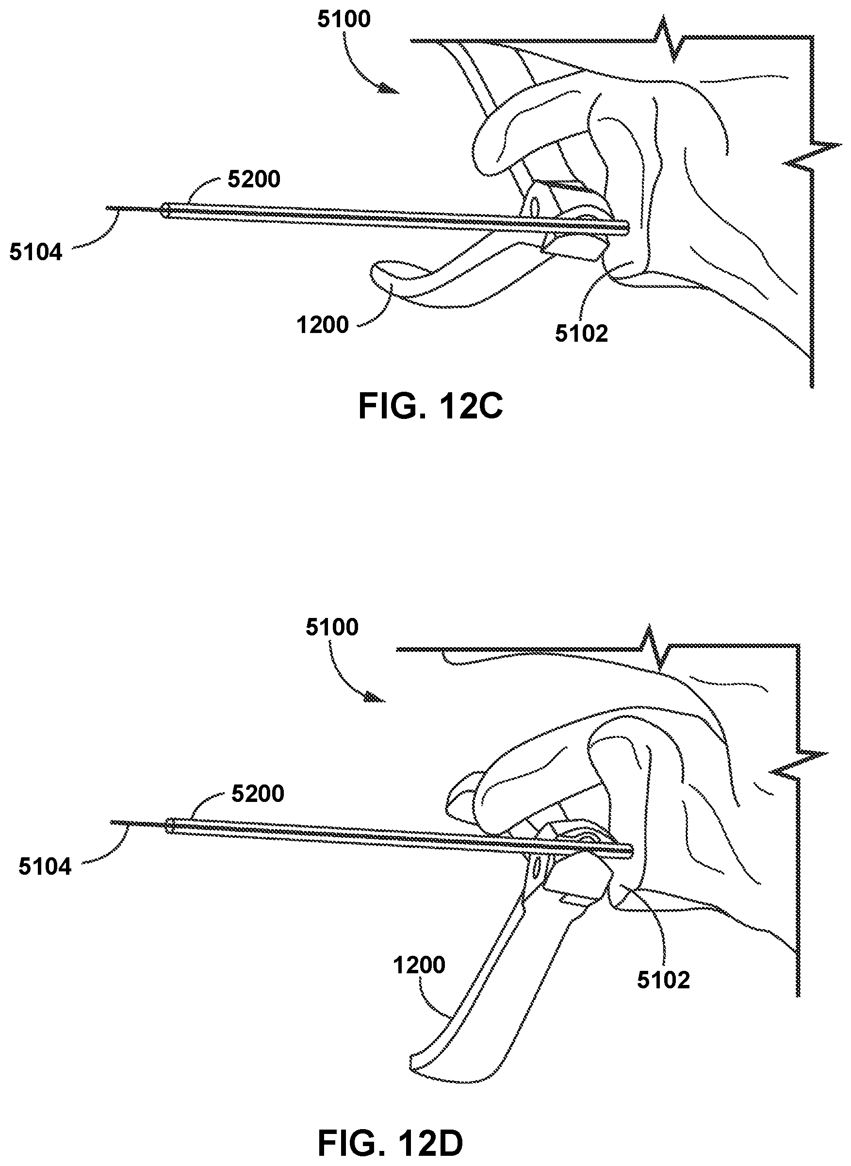 Patent US12472013 Figure 11 – Virtual guidance for correcting surgical pin installation