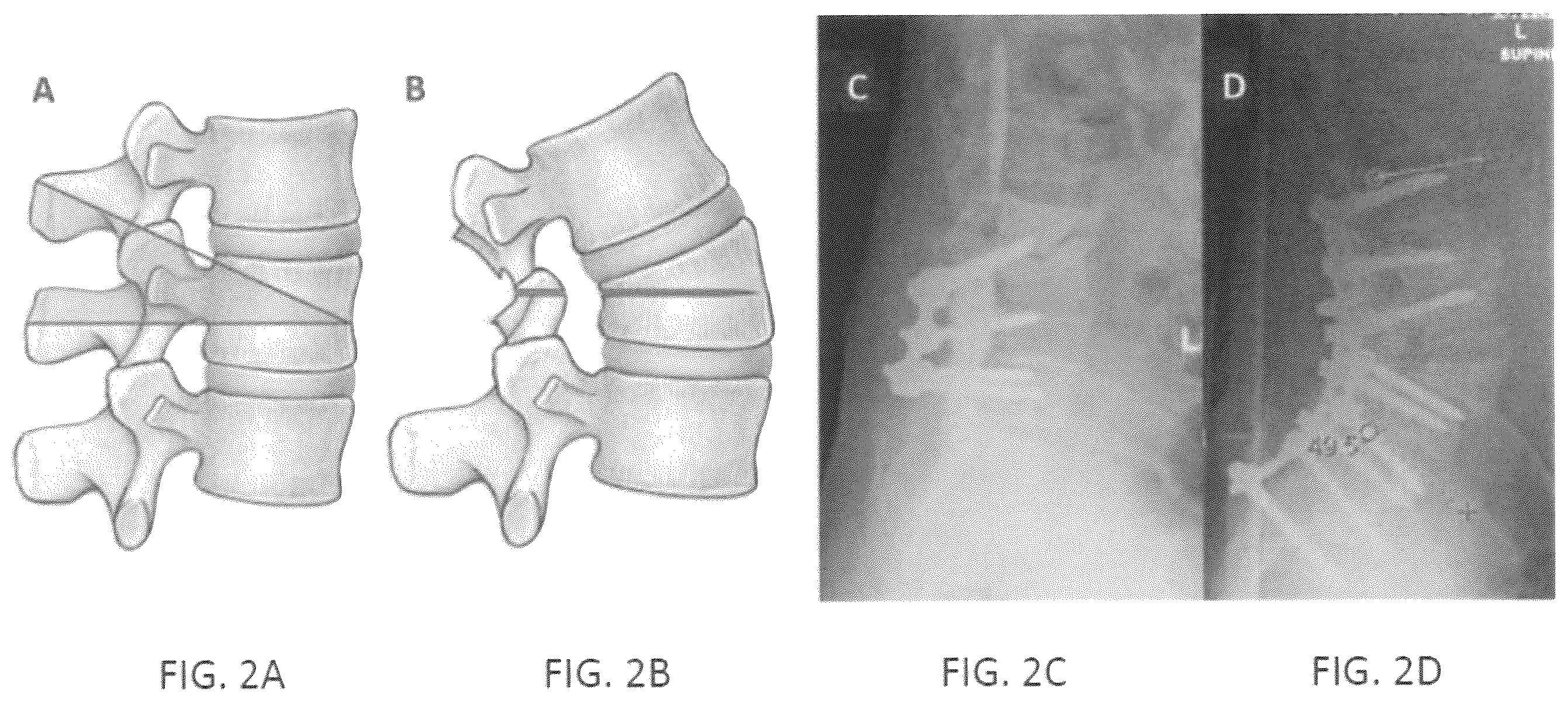 Patent US12472015 Figure 2 – Robotic surgical systems and methods