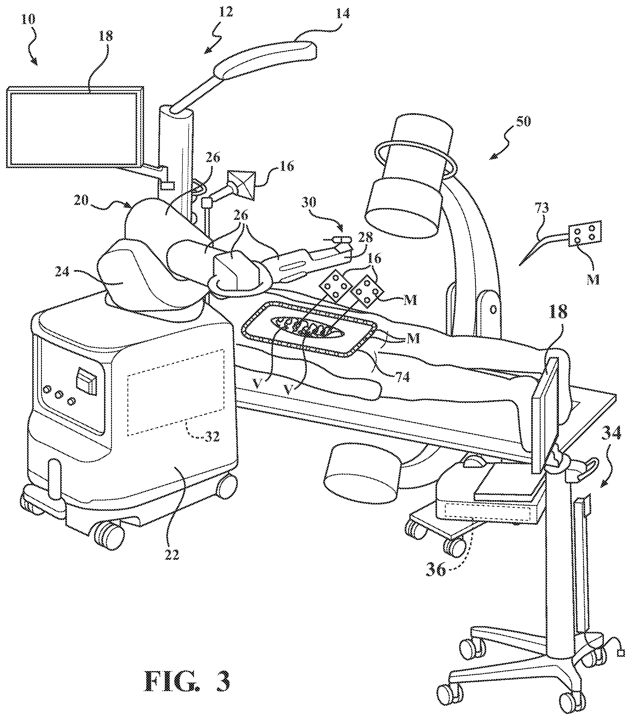 Patent US12472017 Figure 2 – Robotic spine surgery system and methods