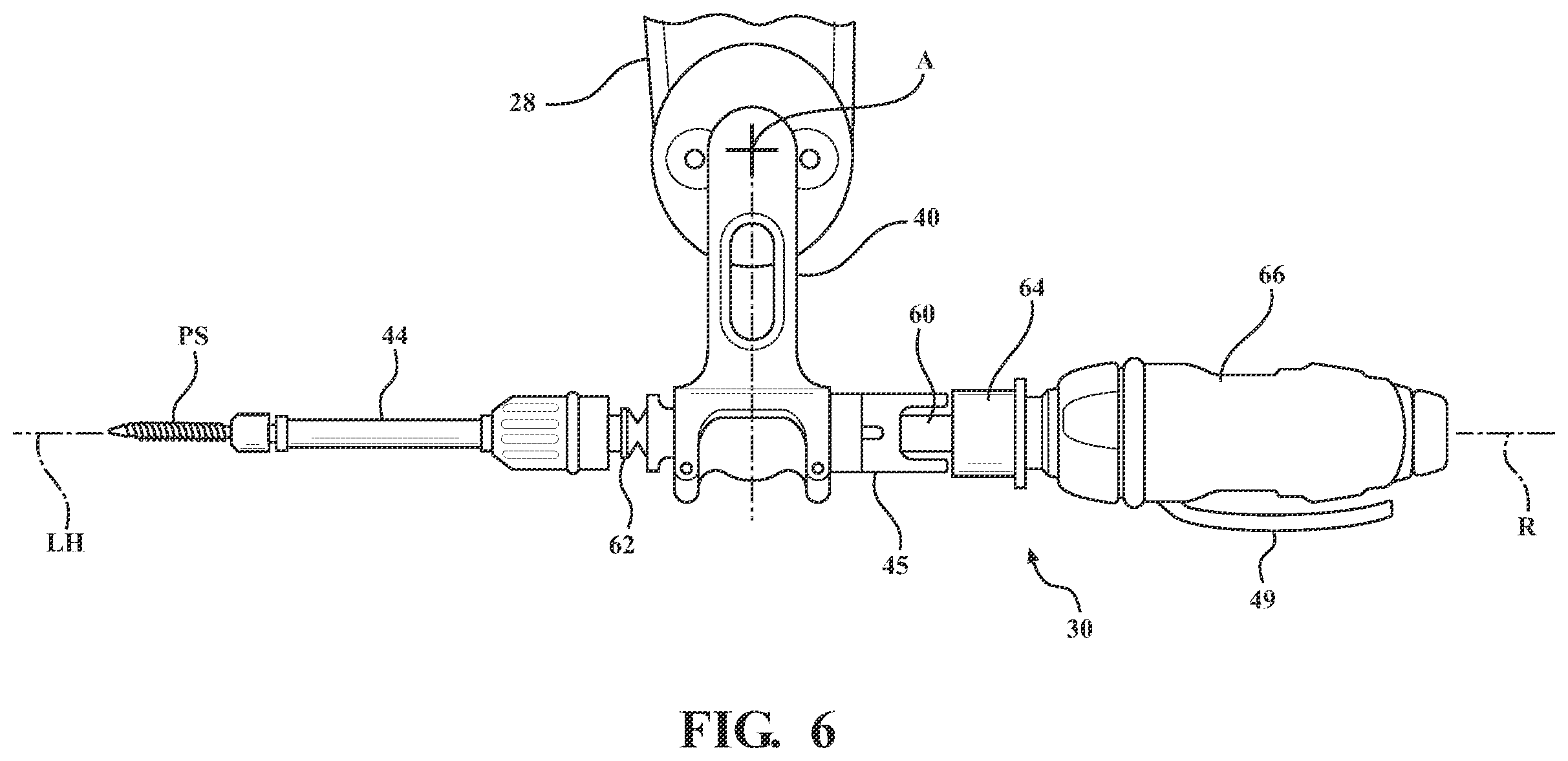 Patent US12472017 Figure 4 – Robotic spine surgery system and methods