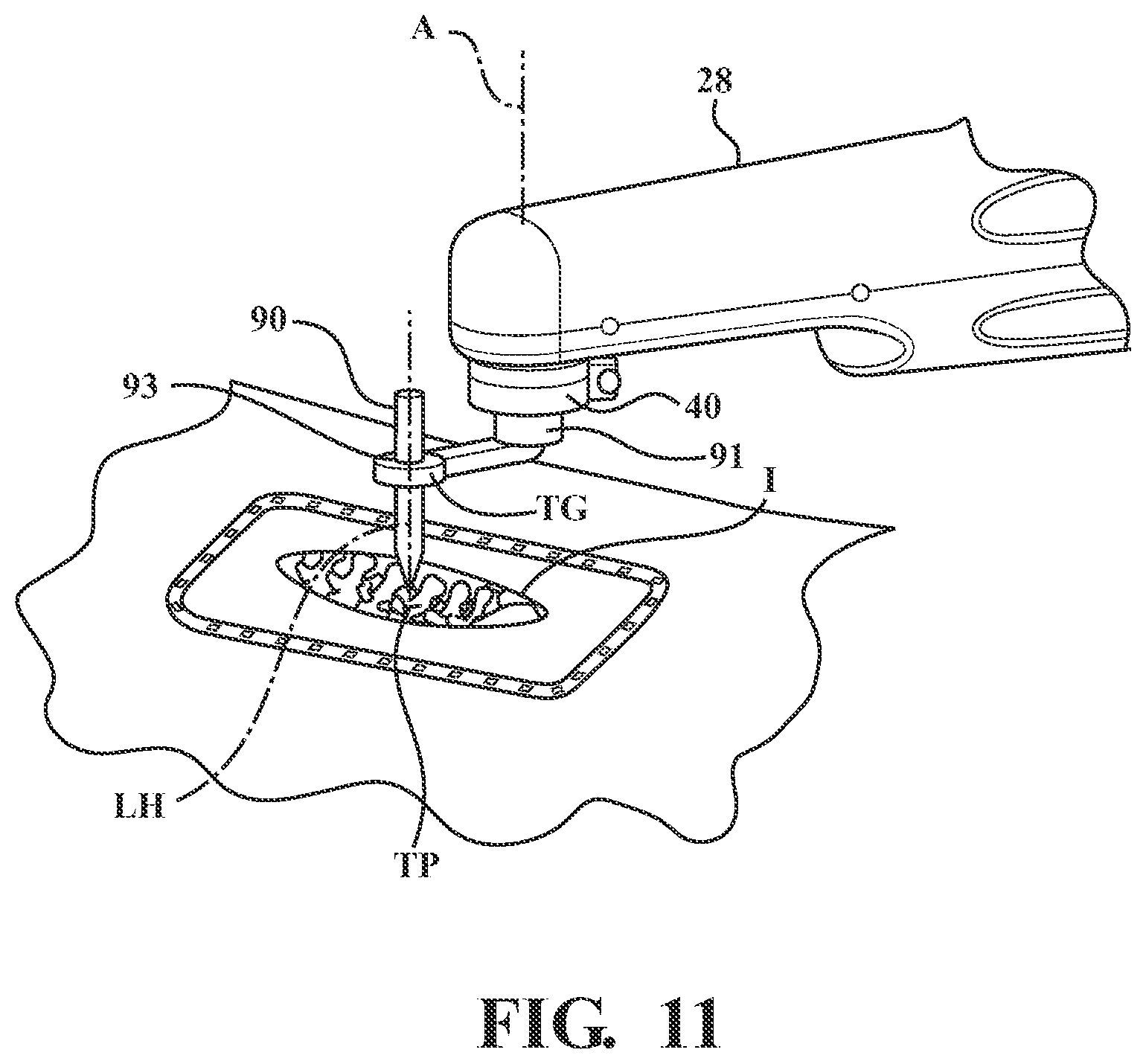 Patent US12472017 Figure 8 – Robotic spine surgery system and methods