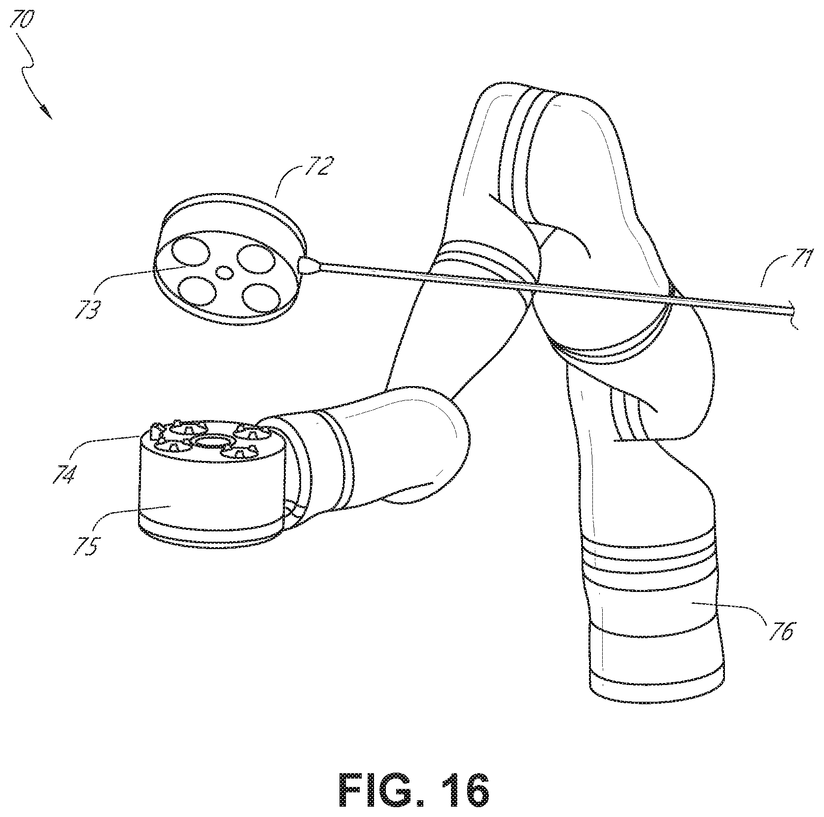 Patent US12472020 Figure 15 – Robotically controlled clot manipulation and removal