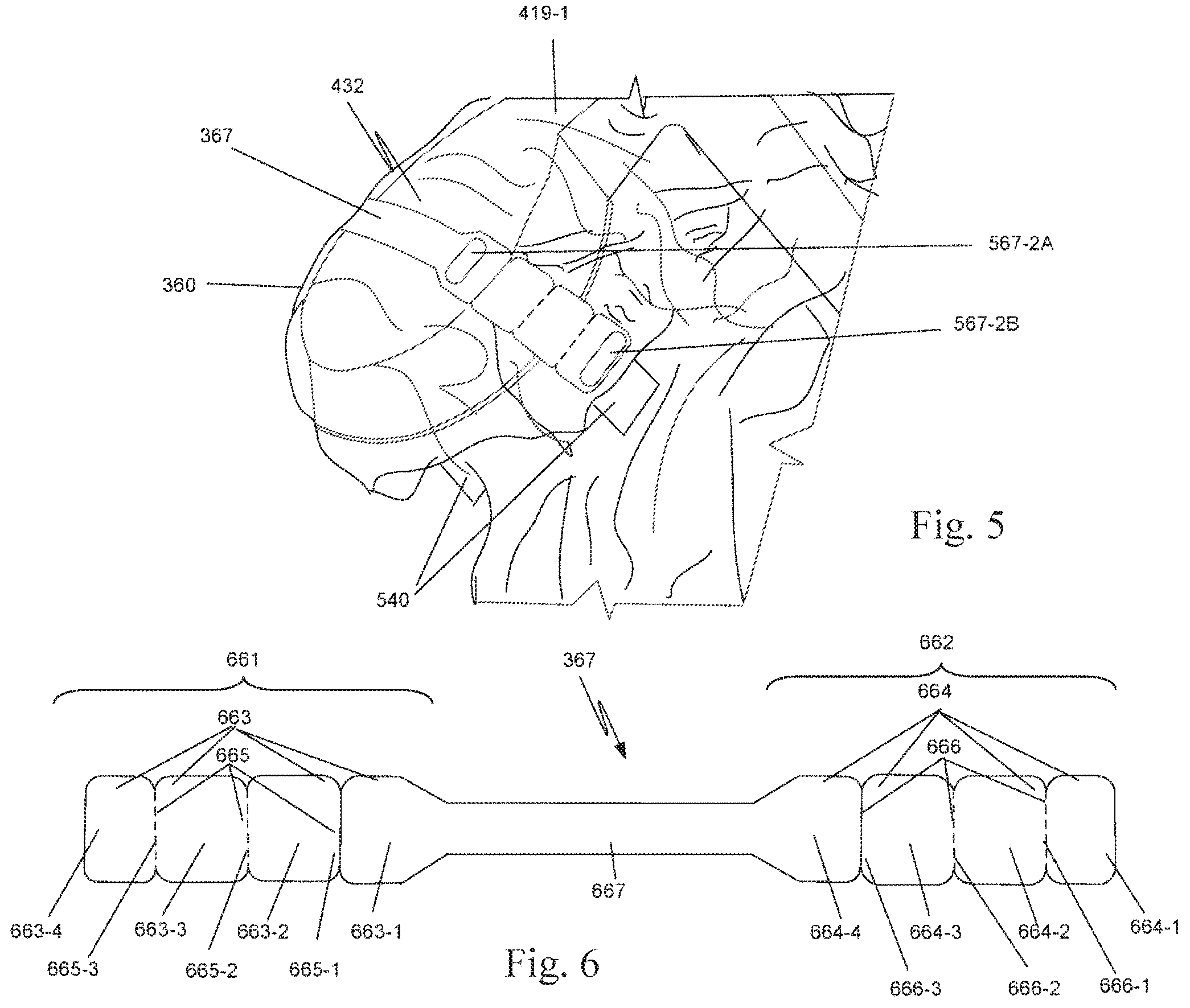 Patent US12472026 Figure 4 – Mechanism for managing and retaining a surgical drape