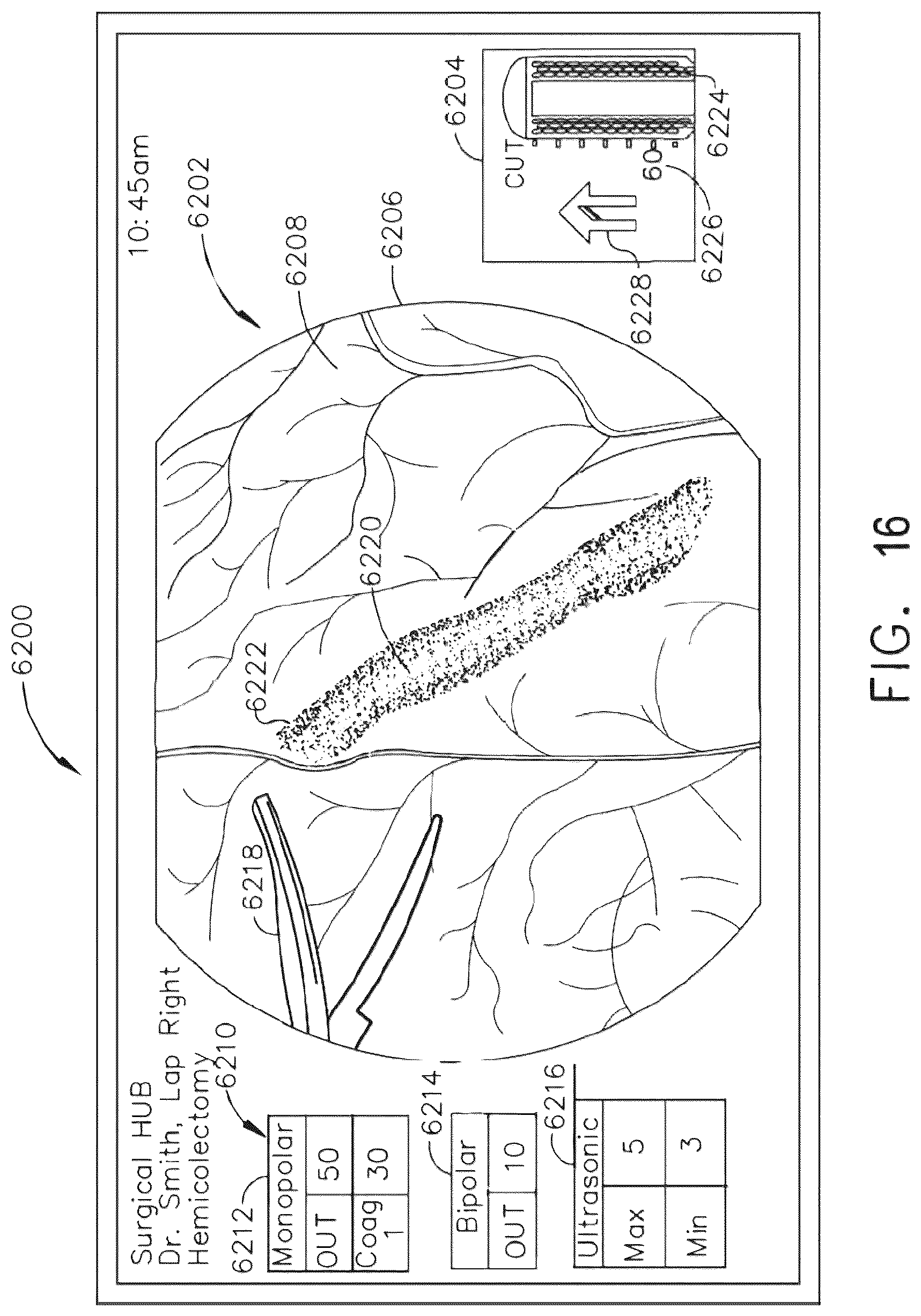 Patent US12472032 Figure 16 – Monitoring of user visual gaze to control which display system displays the primary information