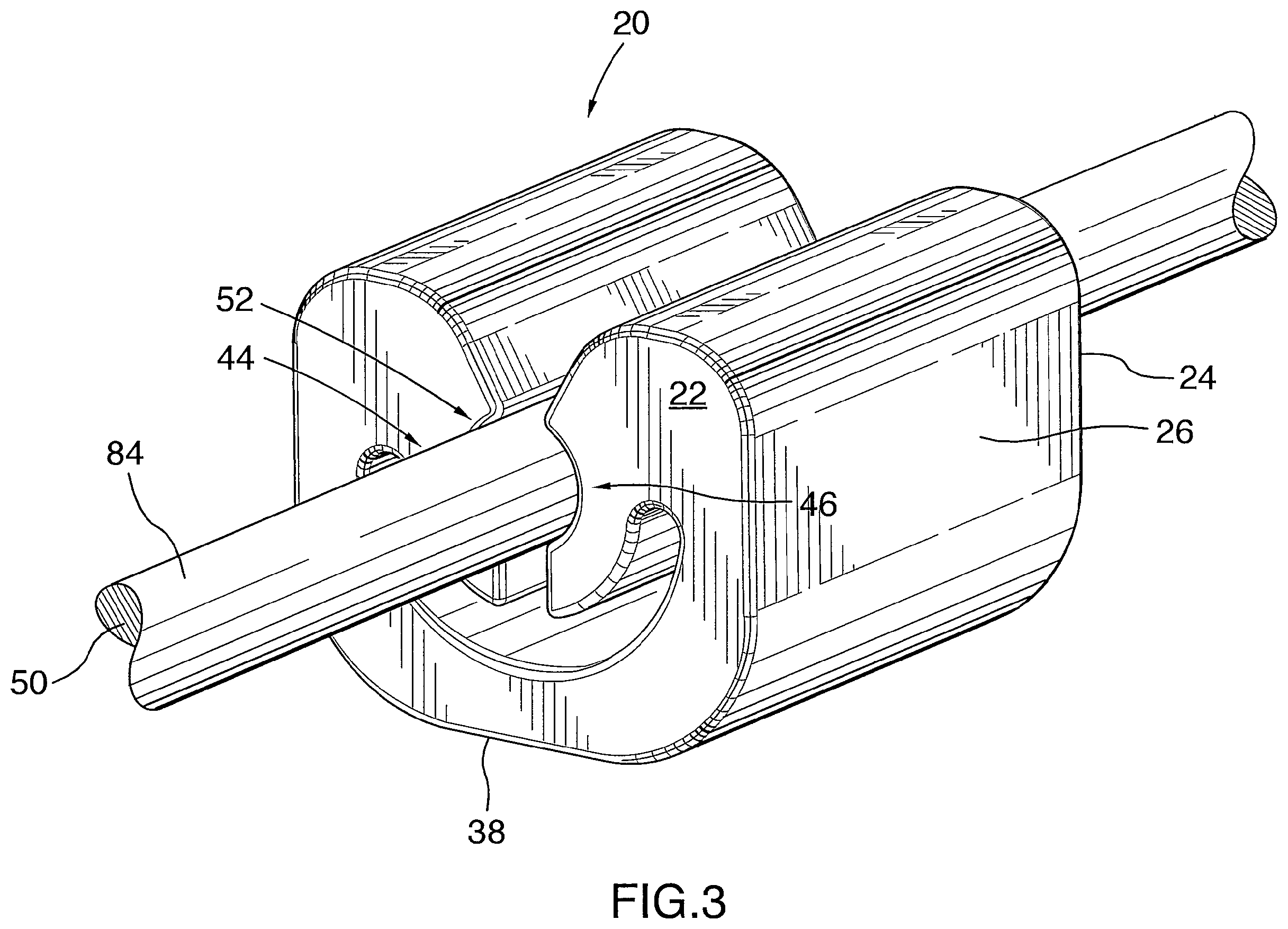 Patent US12472034 Figure 4 – Orthodontic gripping device
