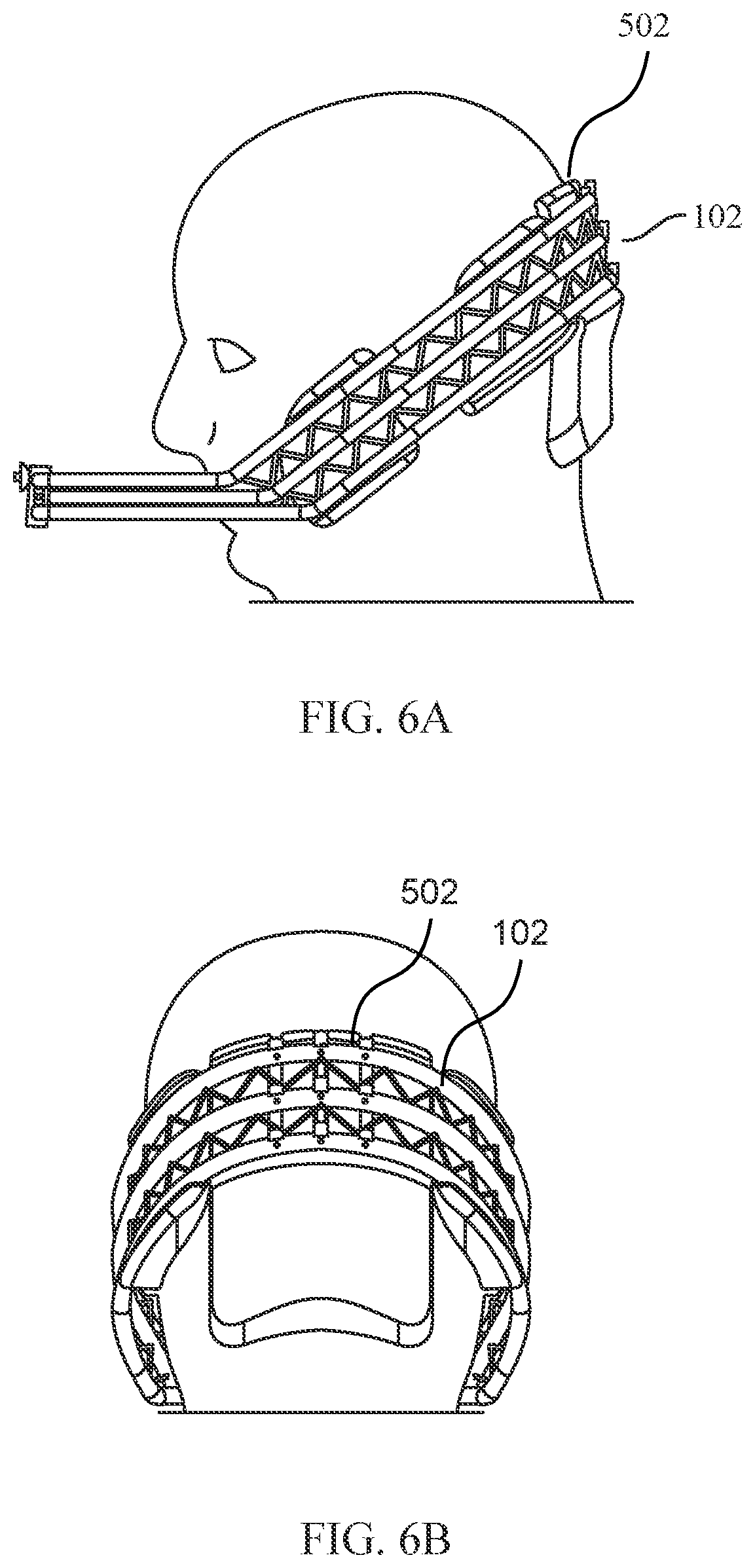 Patent US12472035 Figure 6 – Orthopedic device for midfacial bone structure advancement