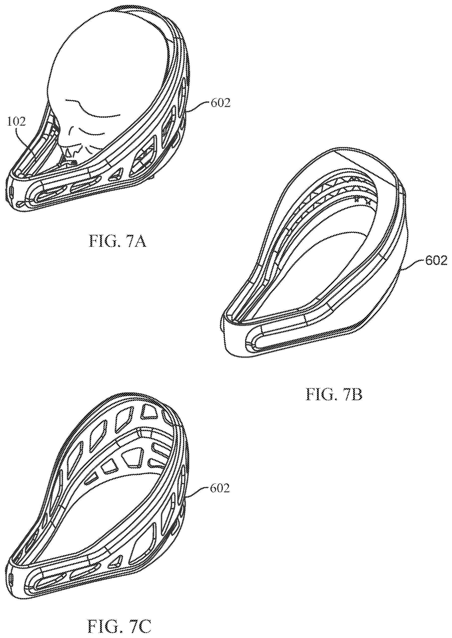 Patent US12472035 Figure 7 – Orthopedic device for midfacial bone structure advancement