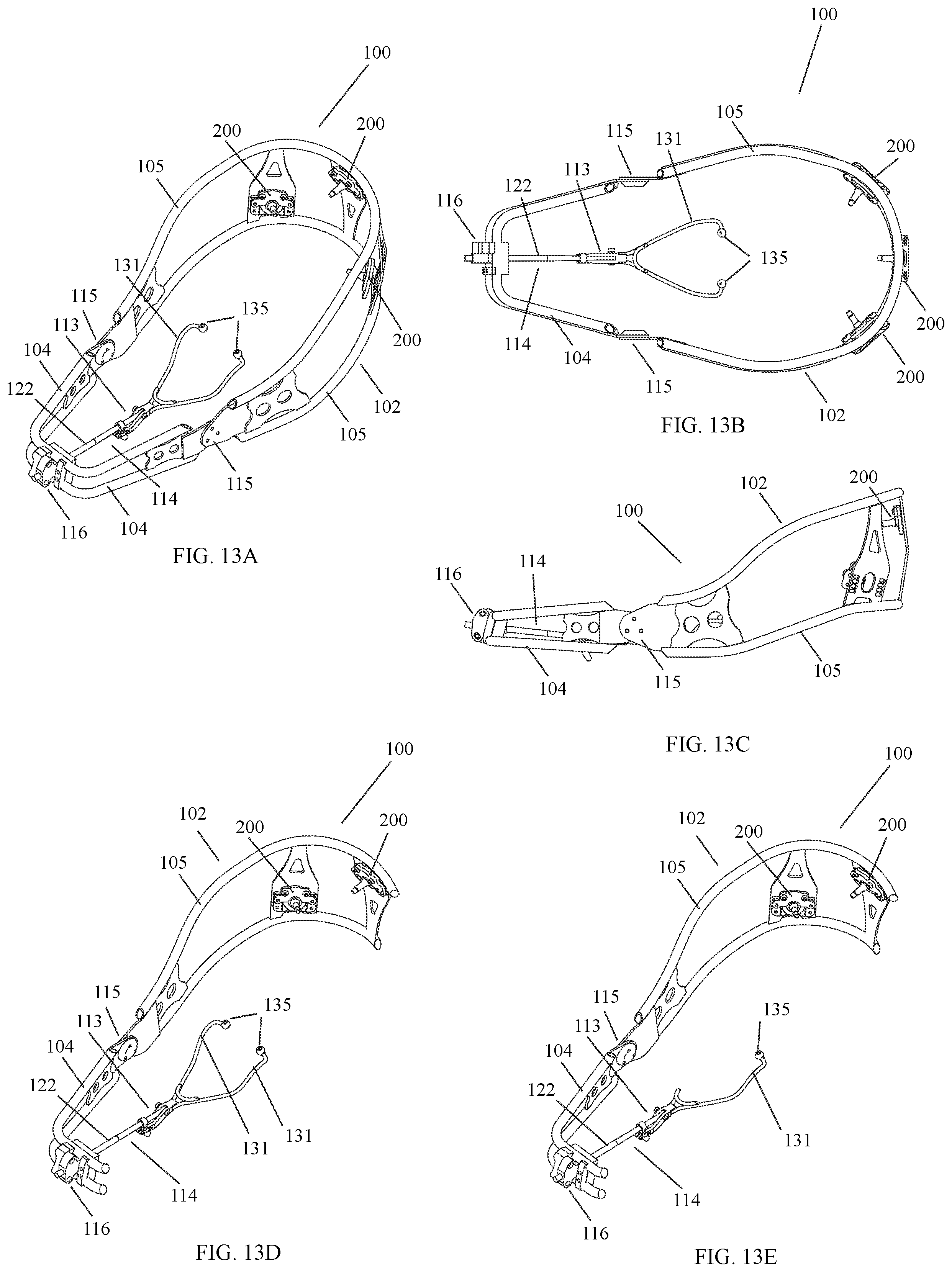 Patent US12472035 Figure 13 – Orthopedic device for midfacial bone structure advancement