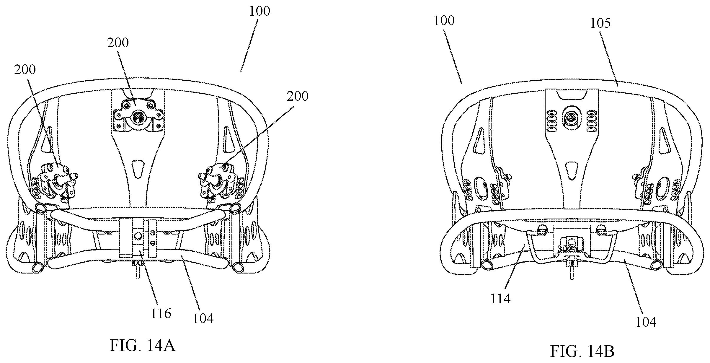 Patent US12472035 Figure 14 – Orthopedic device for midfacial bone structure advancement