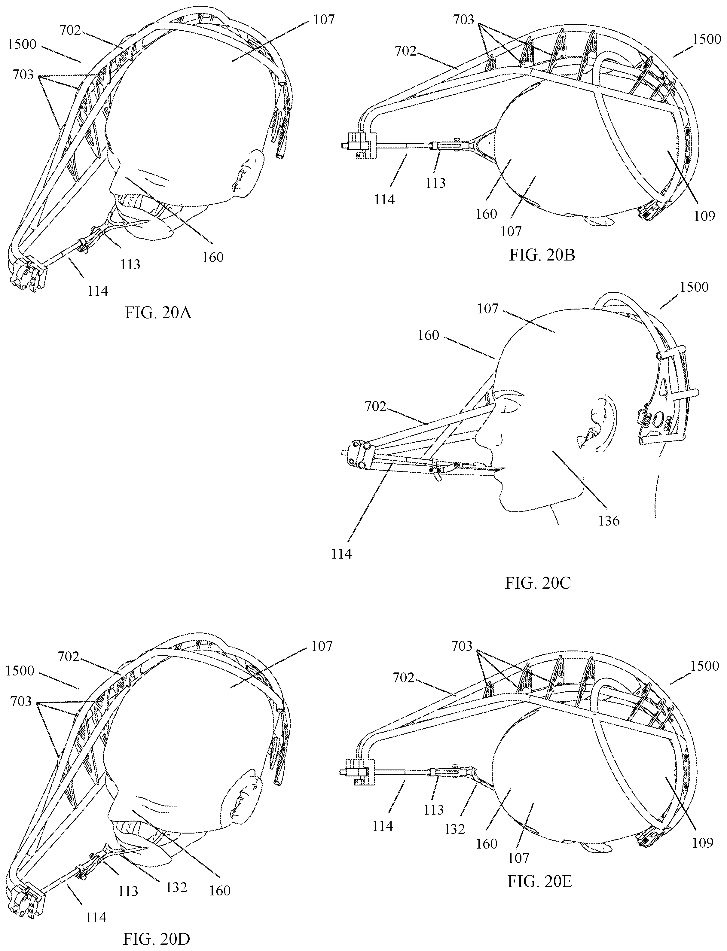 Patent US12472035 Figure 20 – Orthopedic device for midfacial bone structure advancement