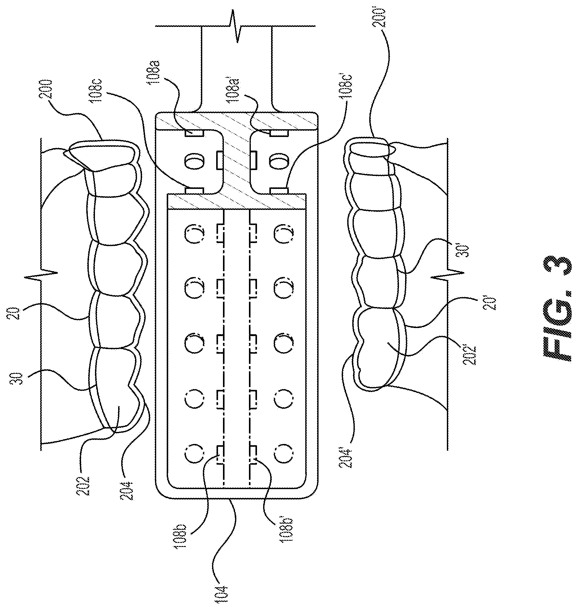 Patent US12472037 Figure 3 – Light-based aligner seating apparatus and methods