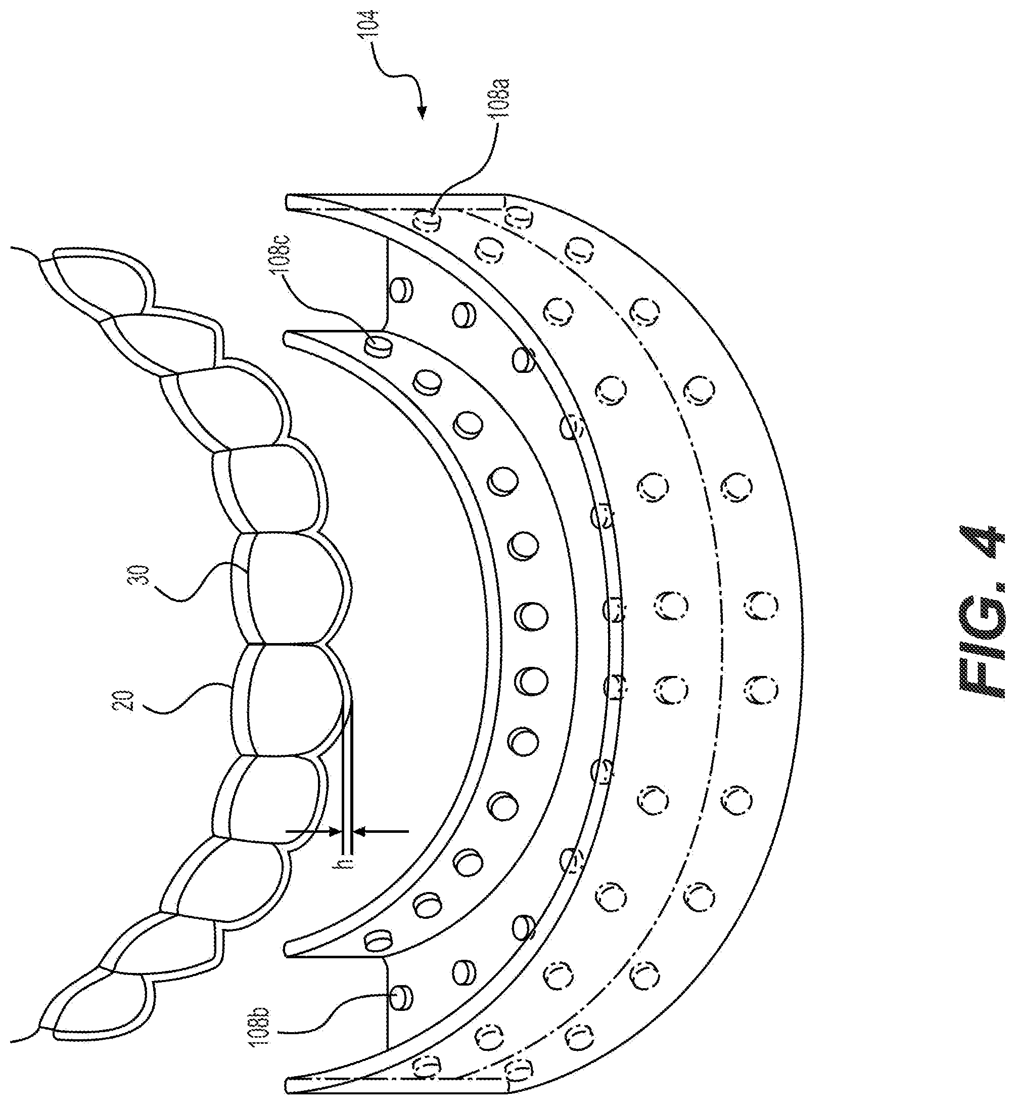 Patent US12472037 Figure 4 – Light-based aligner seating apparatus and methods