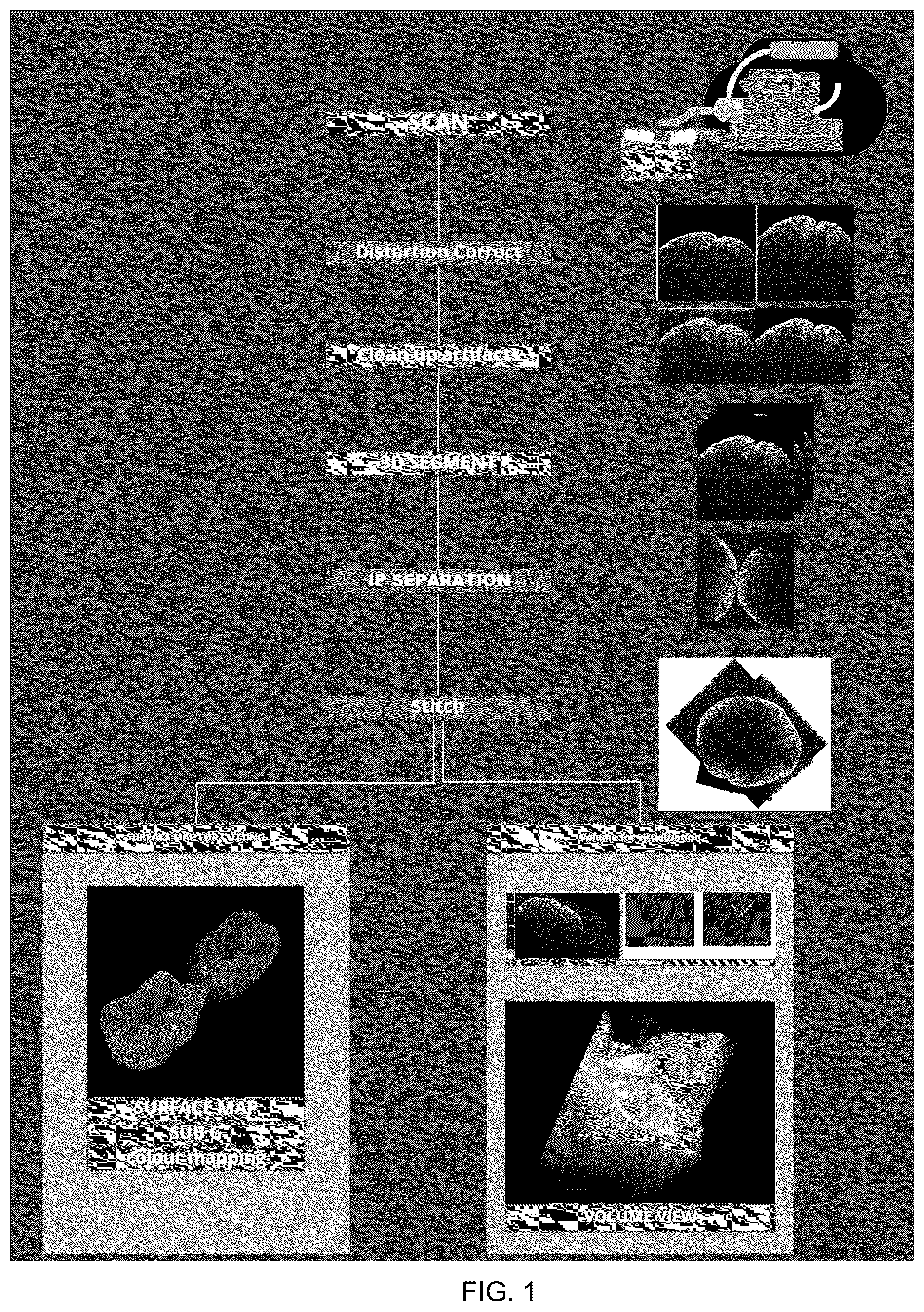 Patent US12472041 Figure 1 – Optical coherence tomography for intra-oral scanning