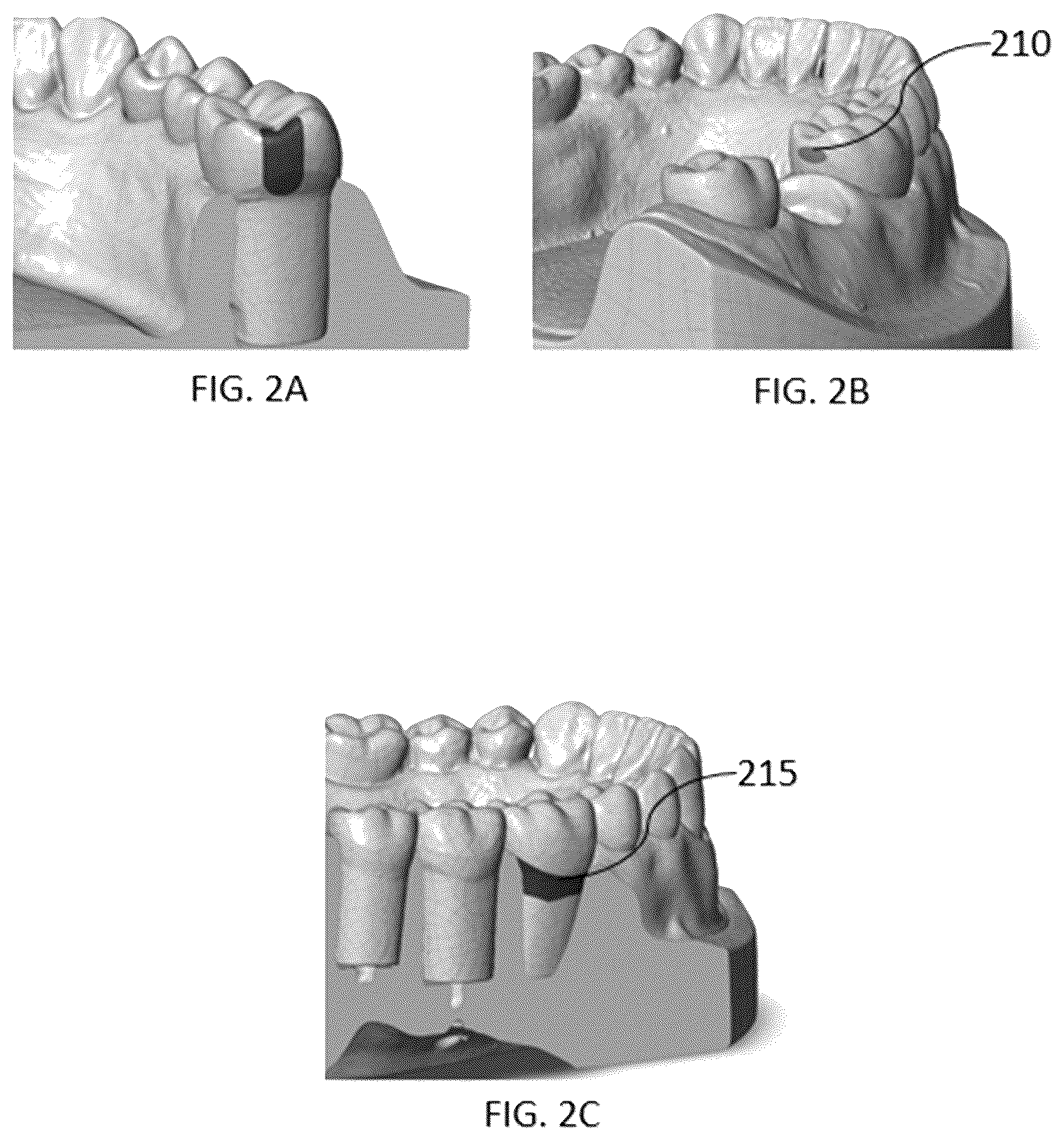 Patent US12472041 Figure 2 – Optical coherence tomography for intra-oral scanning