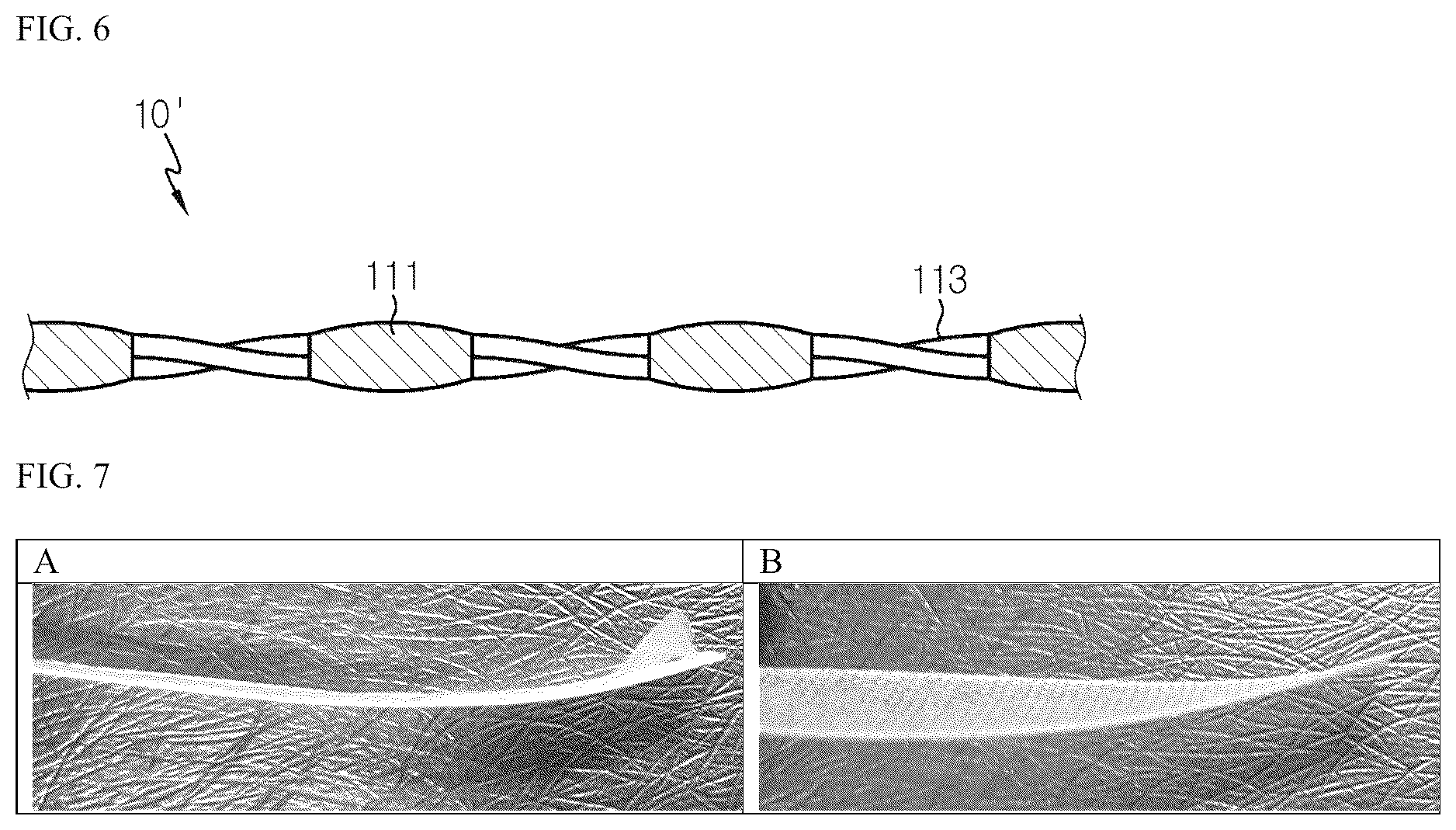 Patent US12472048 Figure 4 – Adhesive patch to oral cavity having improved stability and usability