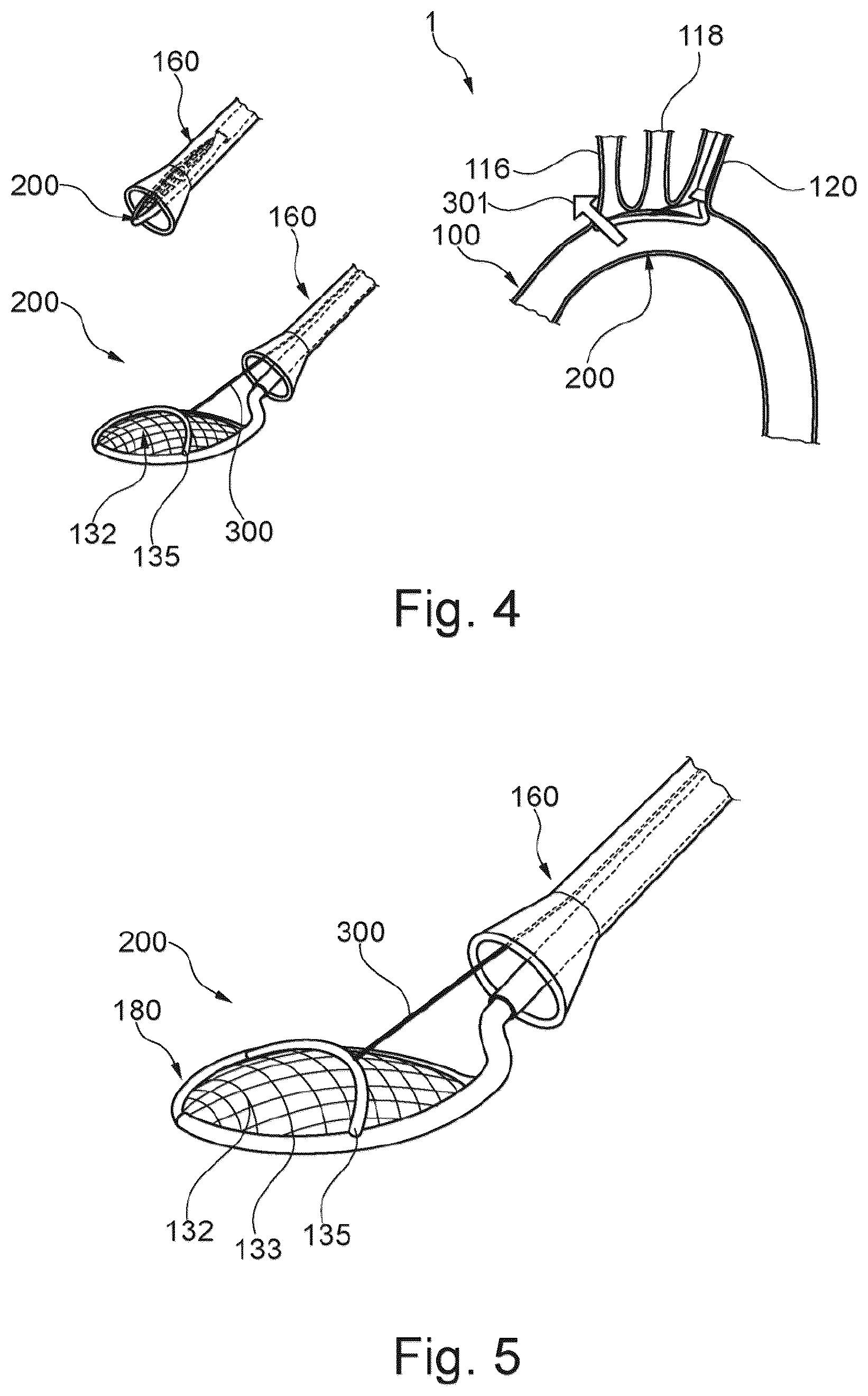 Patent US12472051 Figure 3 – Embolic protection device and method