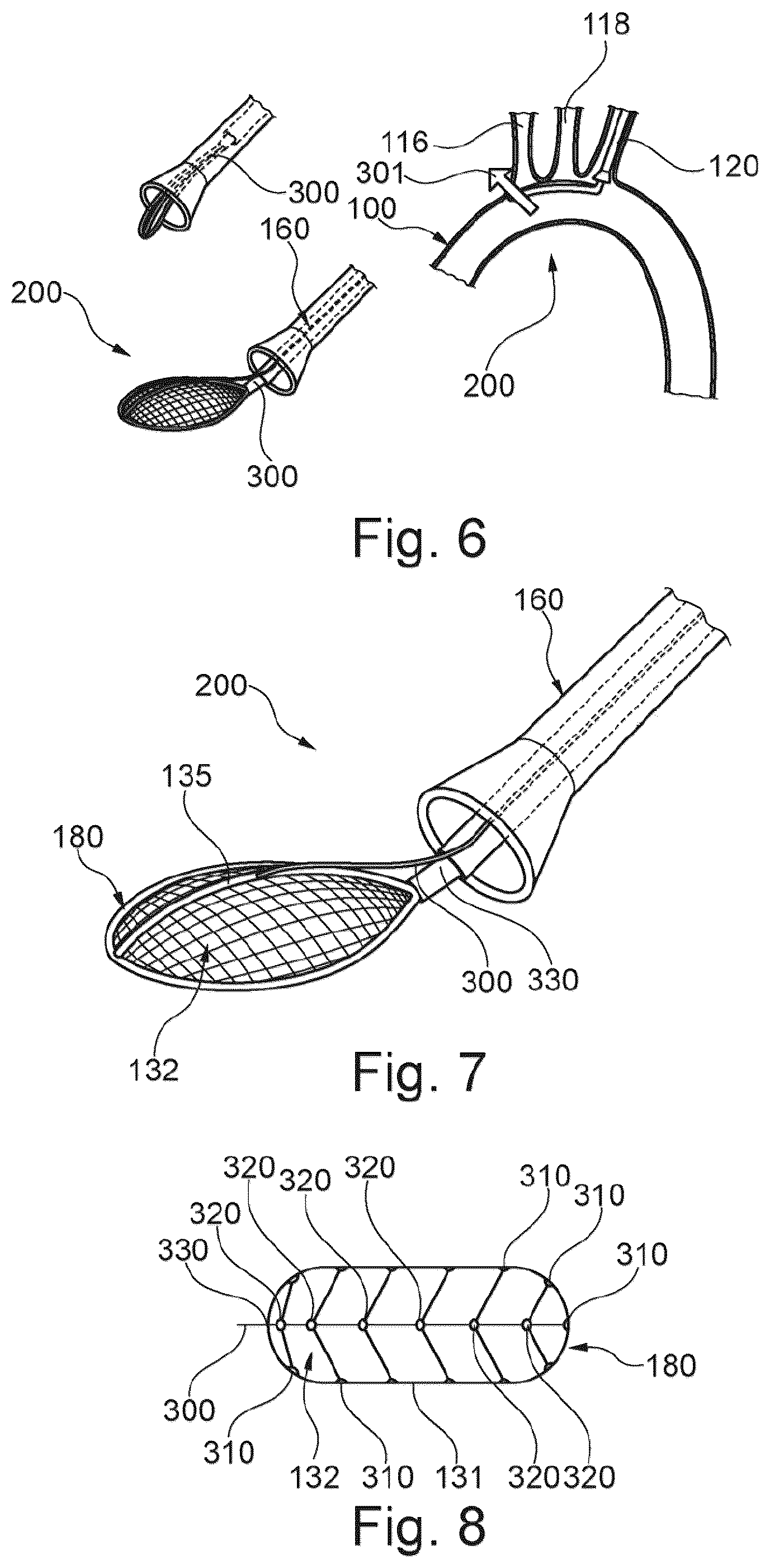 Patent US12472051 Figure 4 – Embolic protection device and method