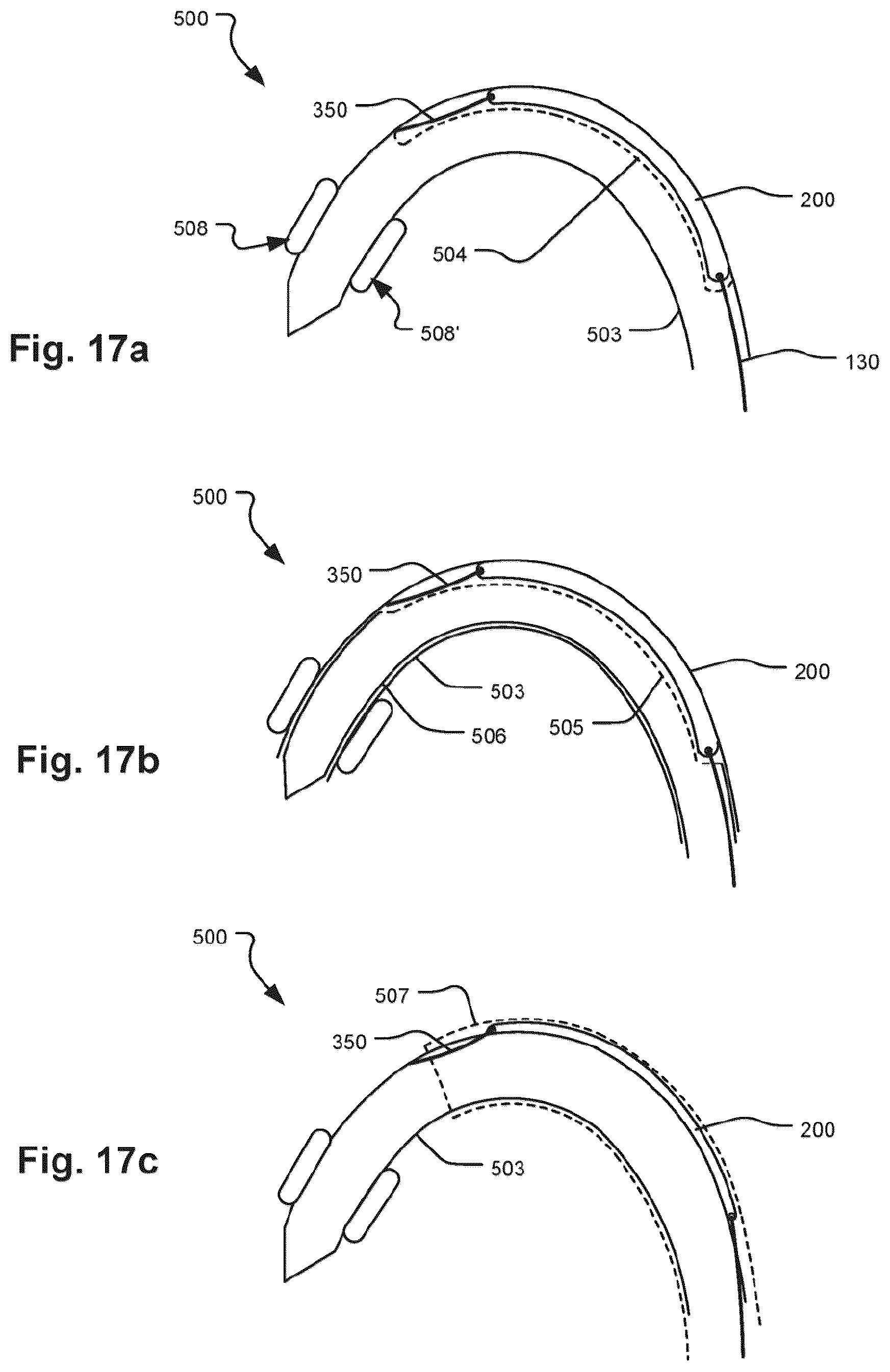 Patent US12472051 Figure 14 – Embolic protection device and method