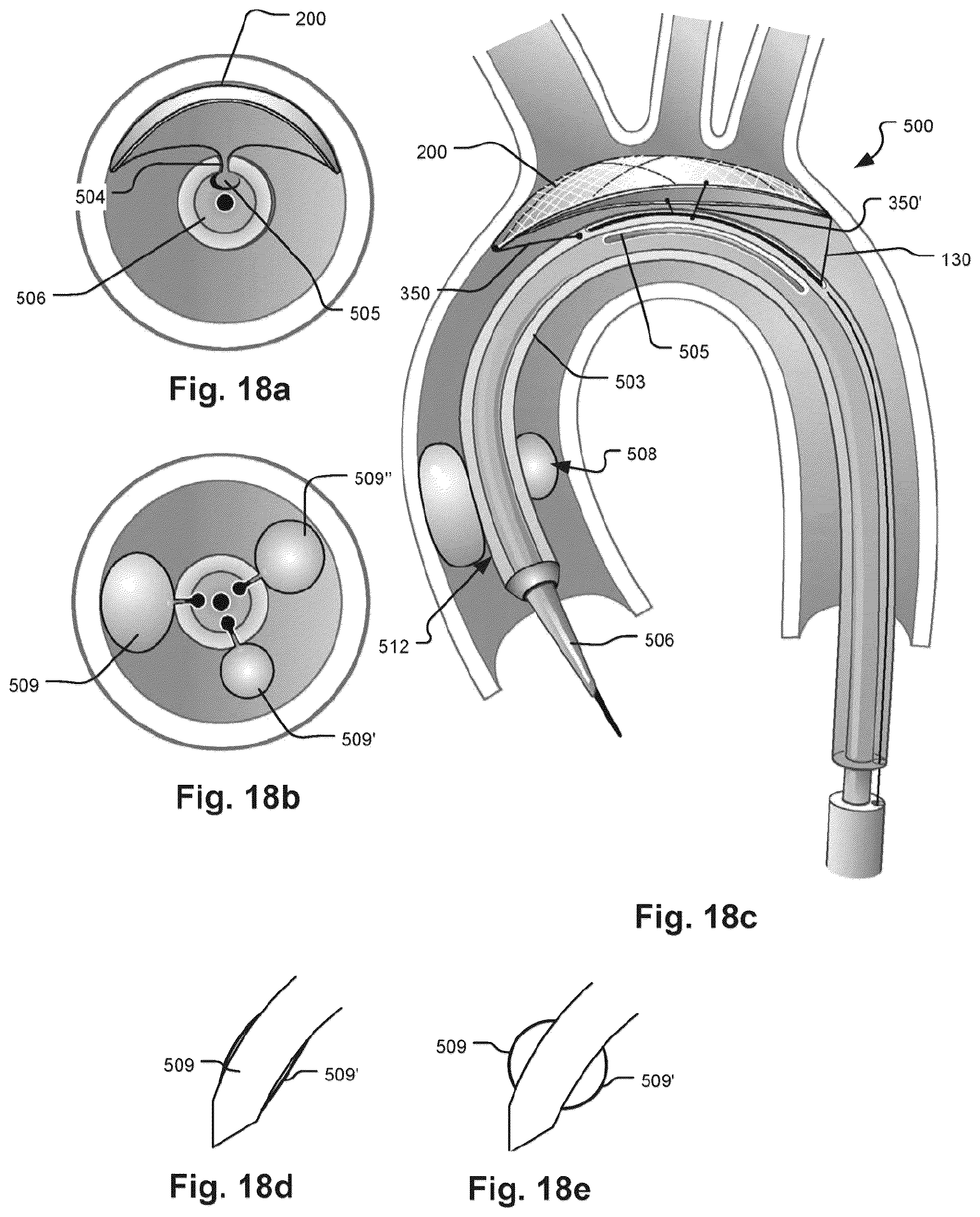 Patent US12472051 Figure 15 – Embolic protection device and method