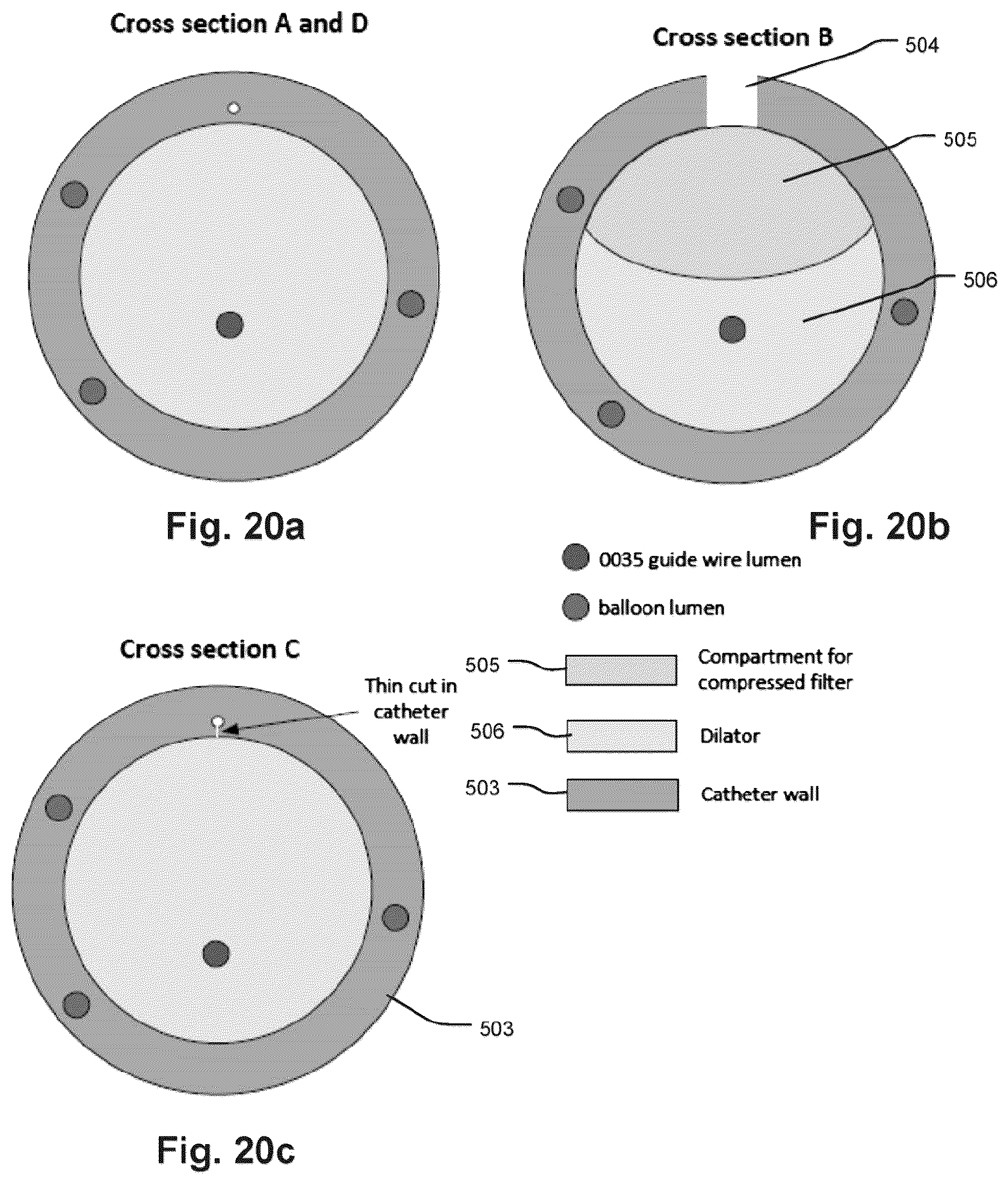 Patent US12472051 Figure 17 – Embolic protection device and method