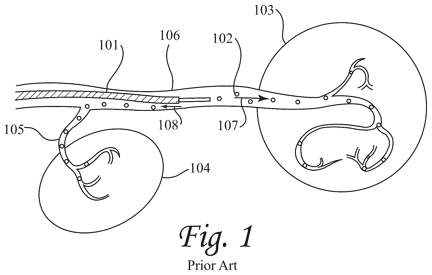 Patent US12472052 Figure 1 – Dynamic microvalve protection device