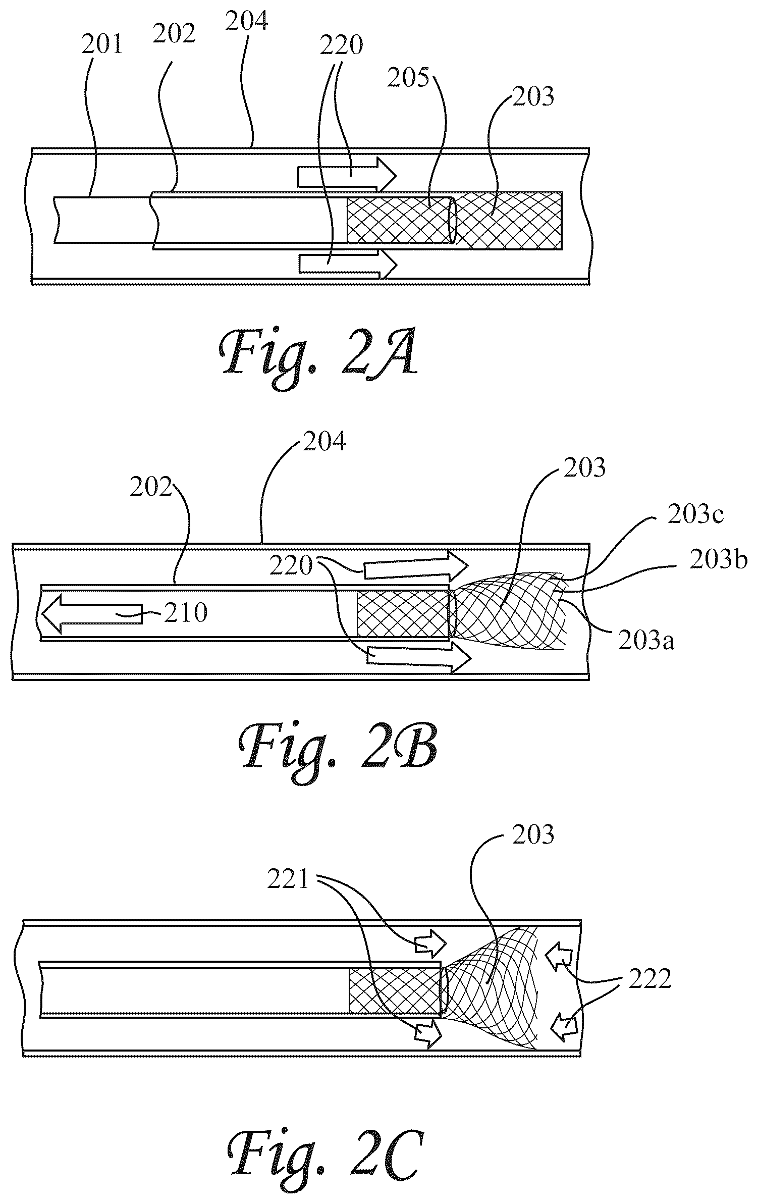 Patent US12472052 Figure 2 – Dynamic microvalve protection device