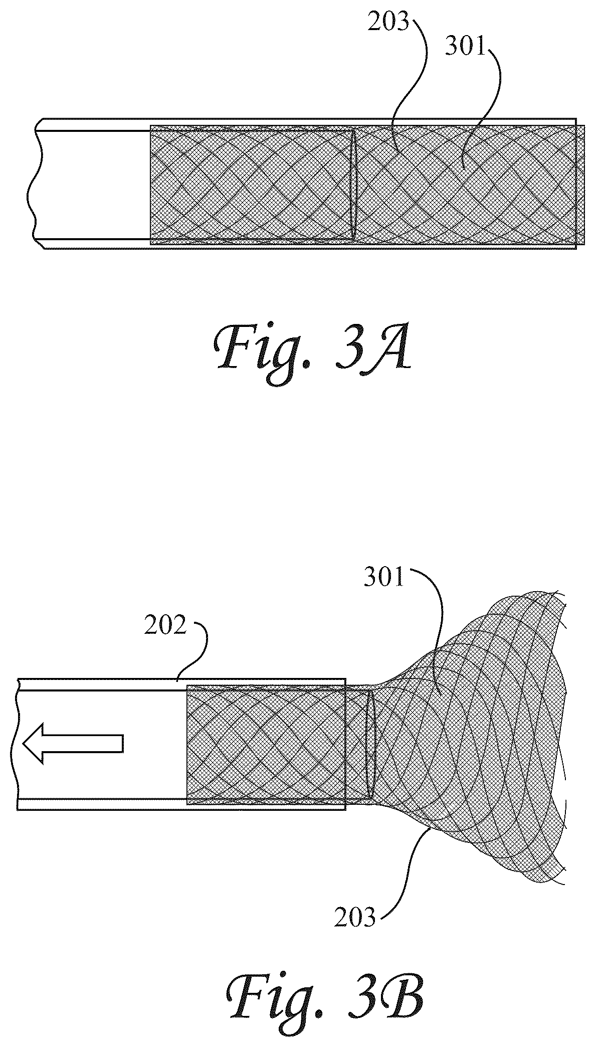 Patent US12472052 Figure 3 – Dynamic microvalve protection device