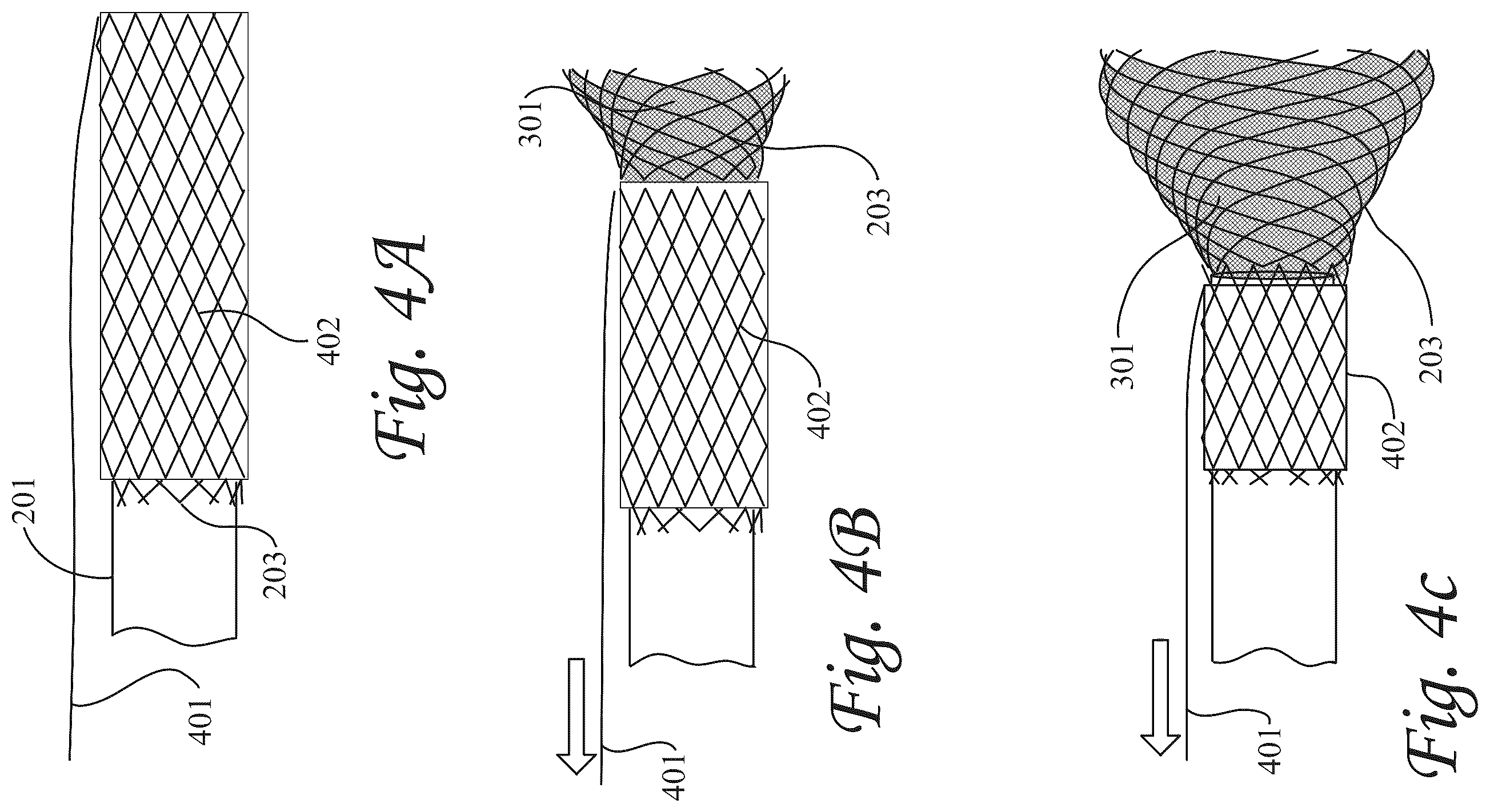 Patent US12472052 Figure 4 – Dynamic microvalve protection device