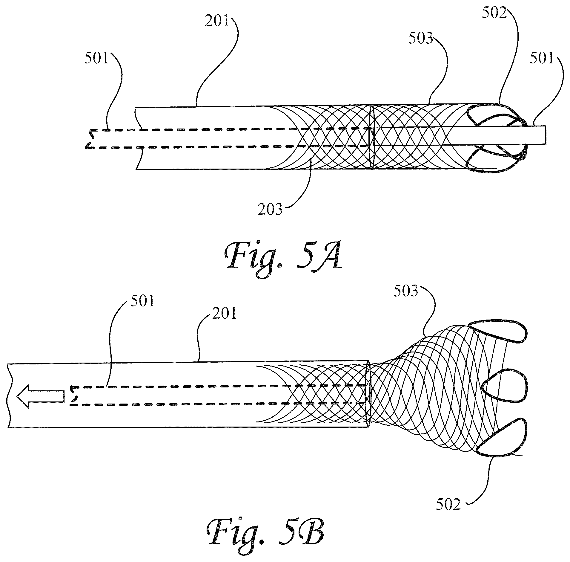 Patent US12472052 Figure 5 – Dynamic microvalve protection device