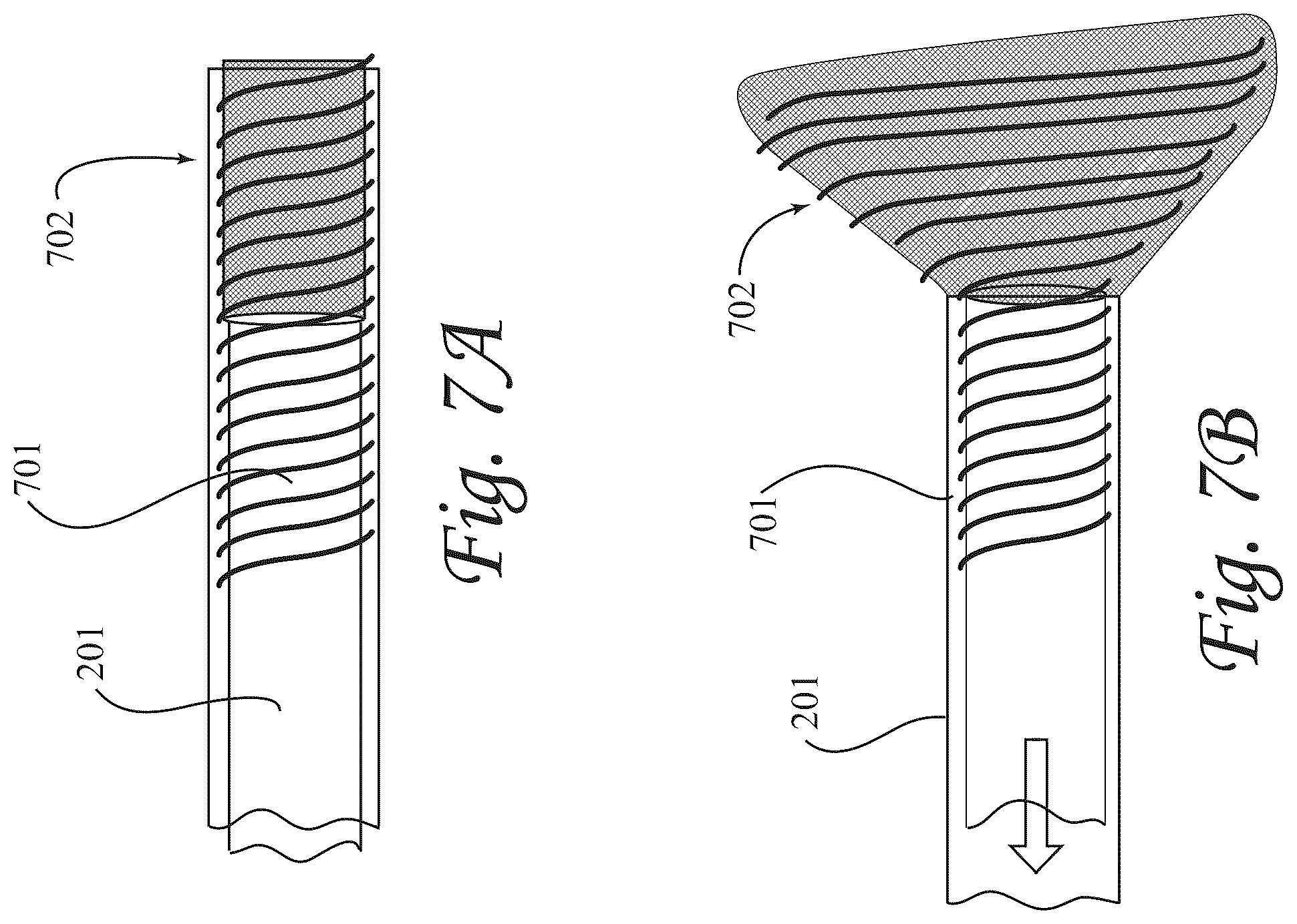 Patent US12472052 Figure 7 – Dynamic microvalve protection device