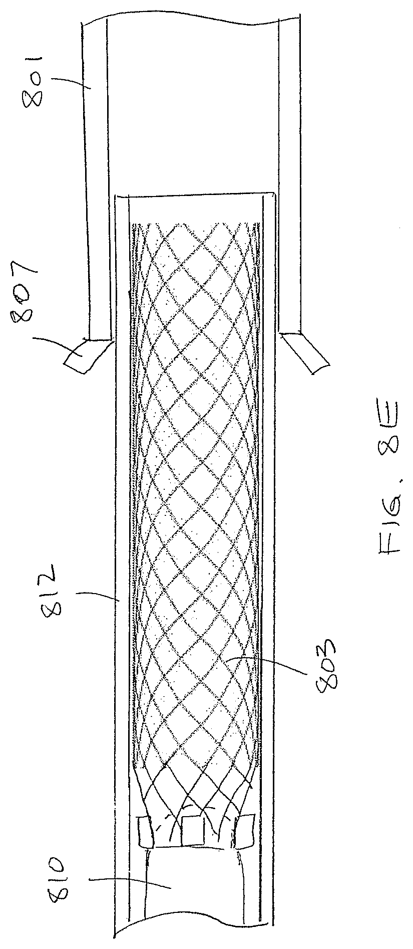 Patent US12472052 Figure 9 – Dynamic microvalve protection device