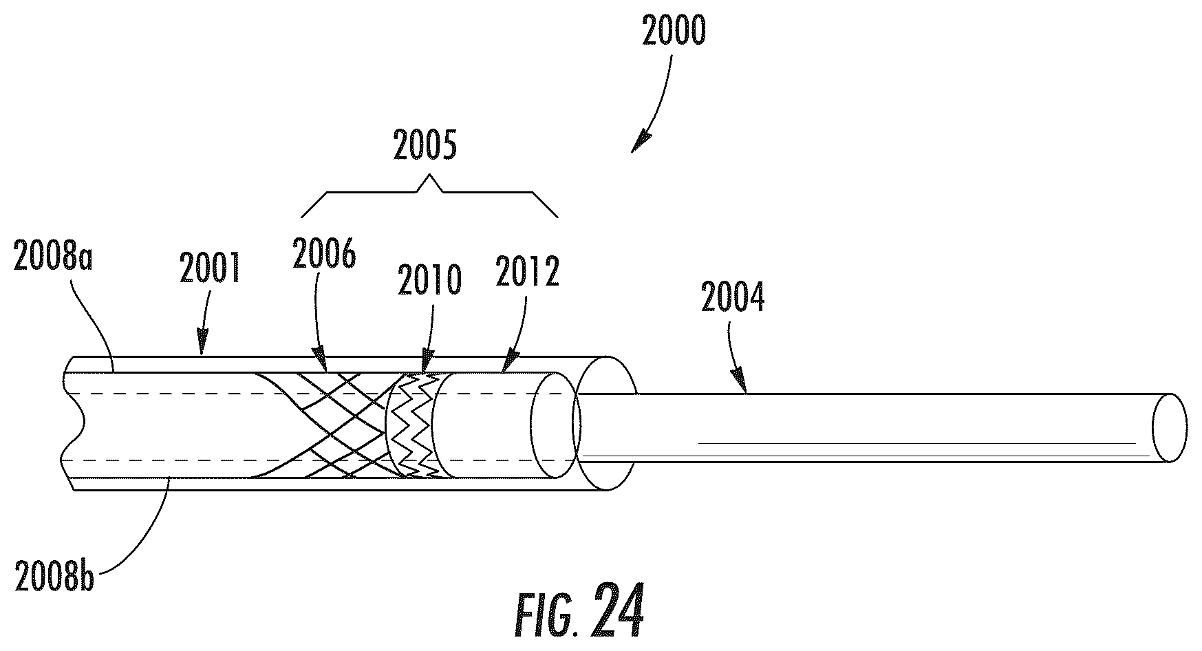Patent US12472052 Figure 16 – Dynamic microvalve protection device