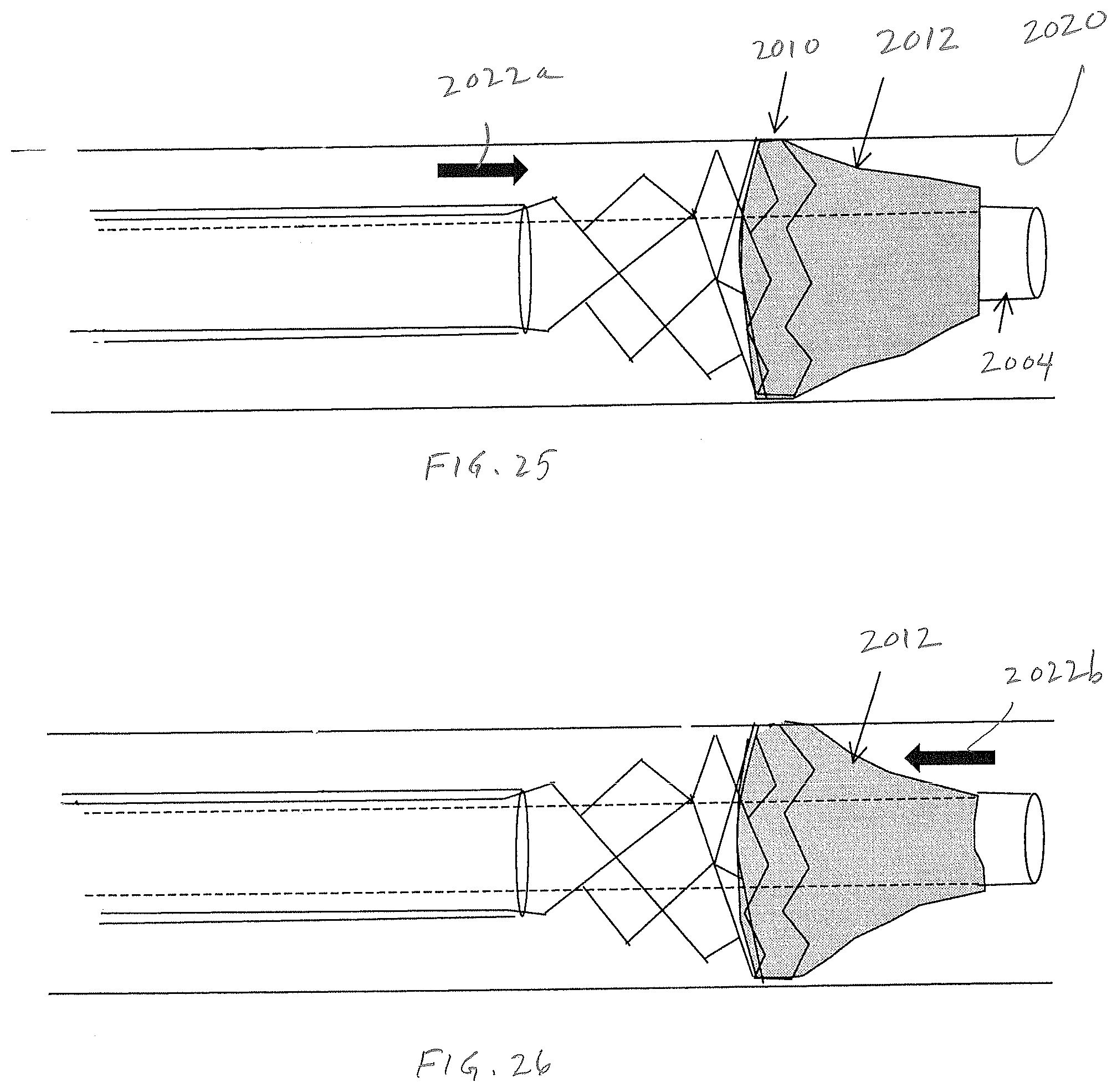 Patent US12472052 Figure 17 – Dynamic microvalve protection device
