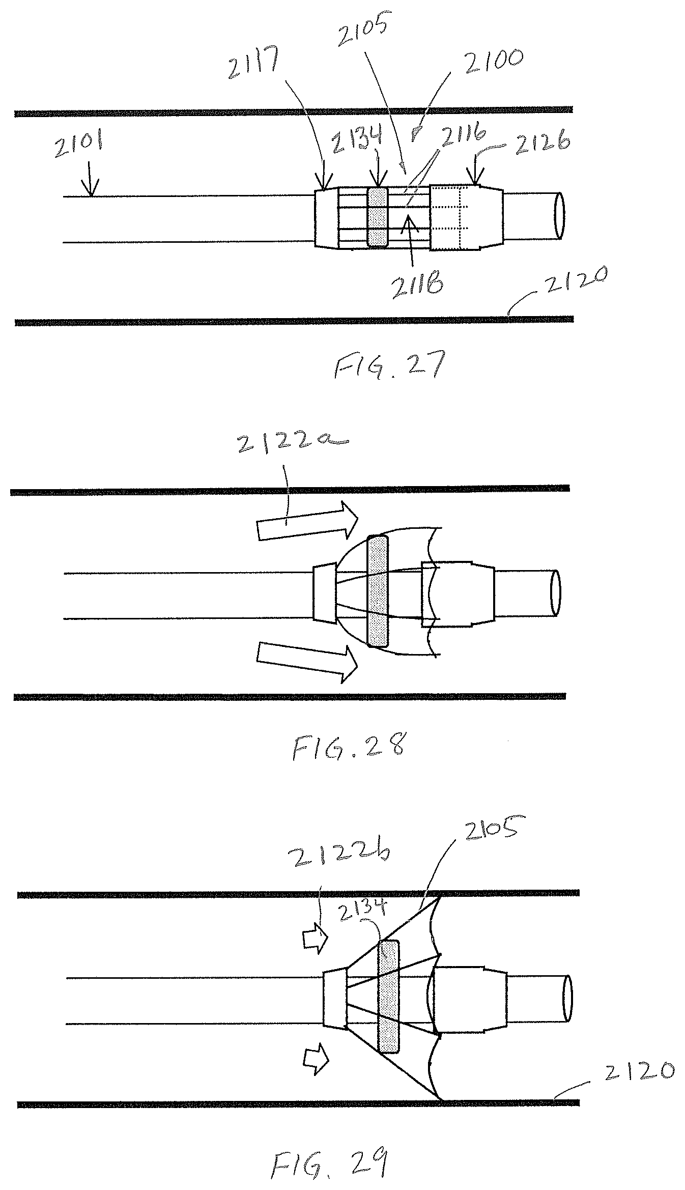 Patent US12472052 Figure 18 – Dynamic microvalve protection device