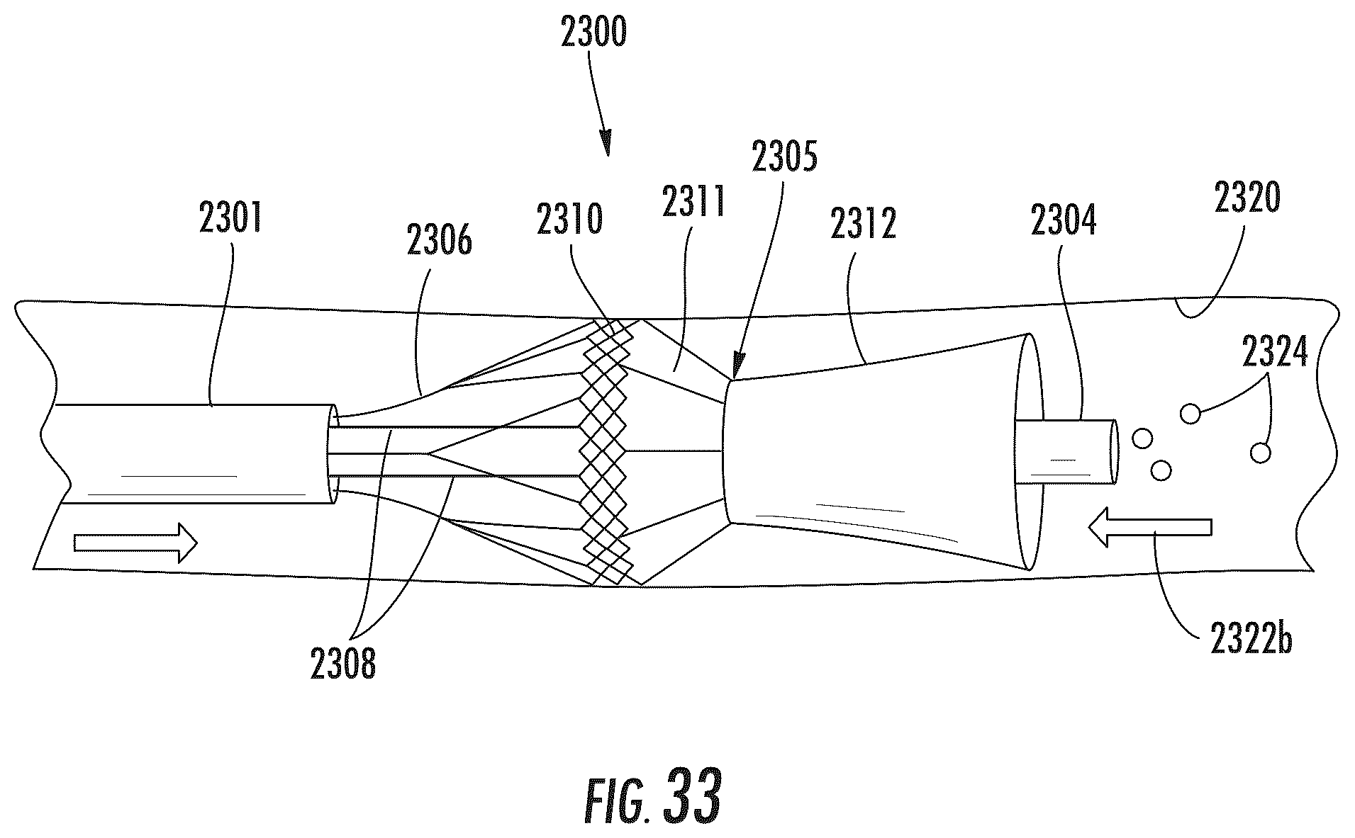 Patent US12472052 Figure 20 – Dynamic microvalve protection device