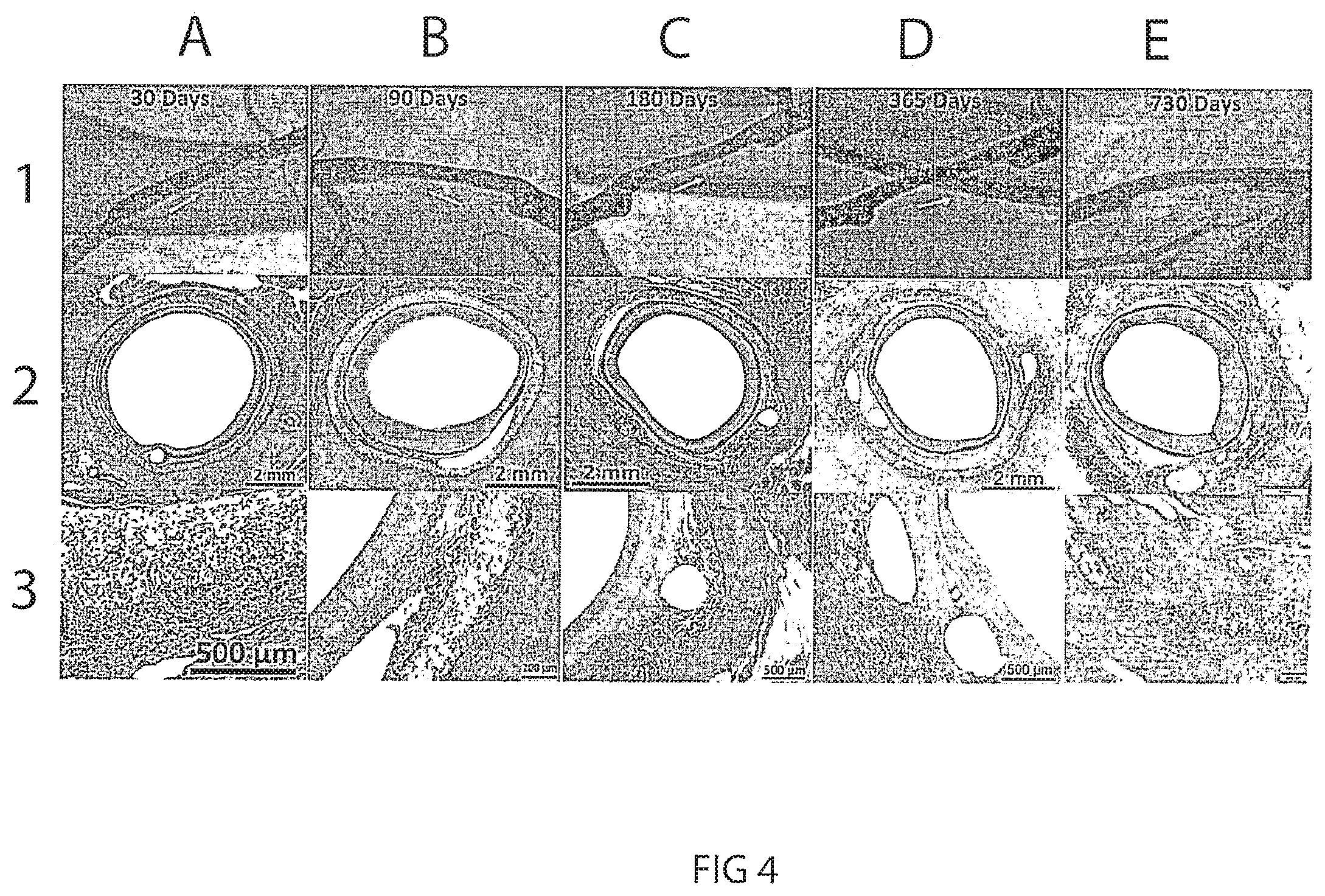 Patent US12472053 Figure 7 – Multiple layer vascular graft
