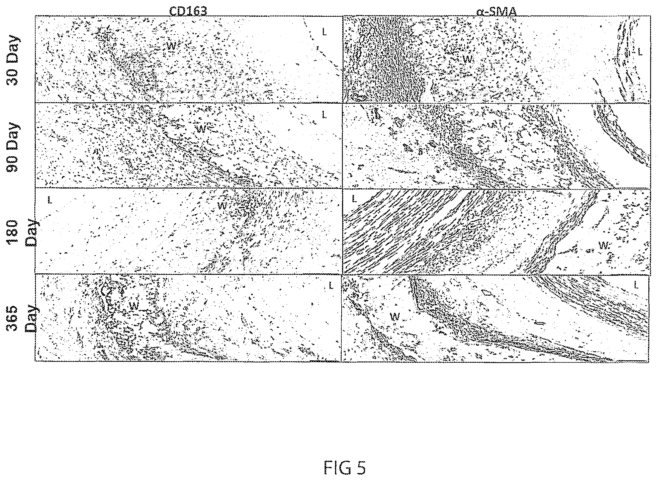 Patent US12472053 Figure 8 – Multiple layer vascular graft