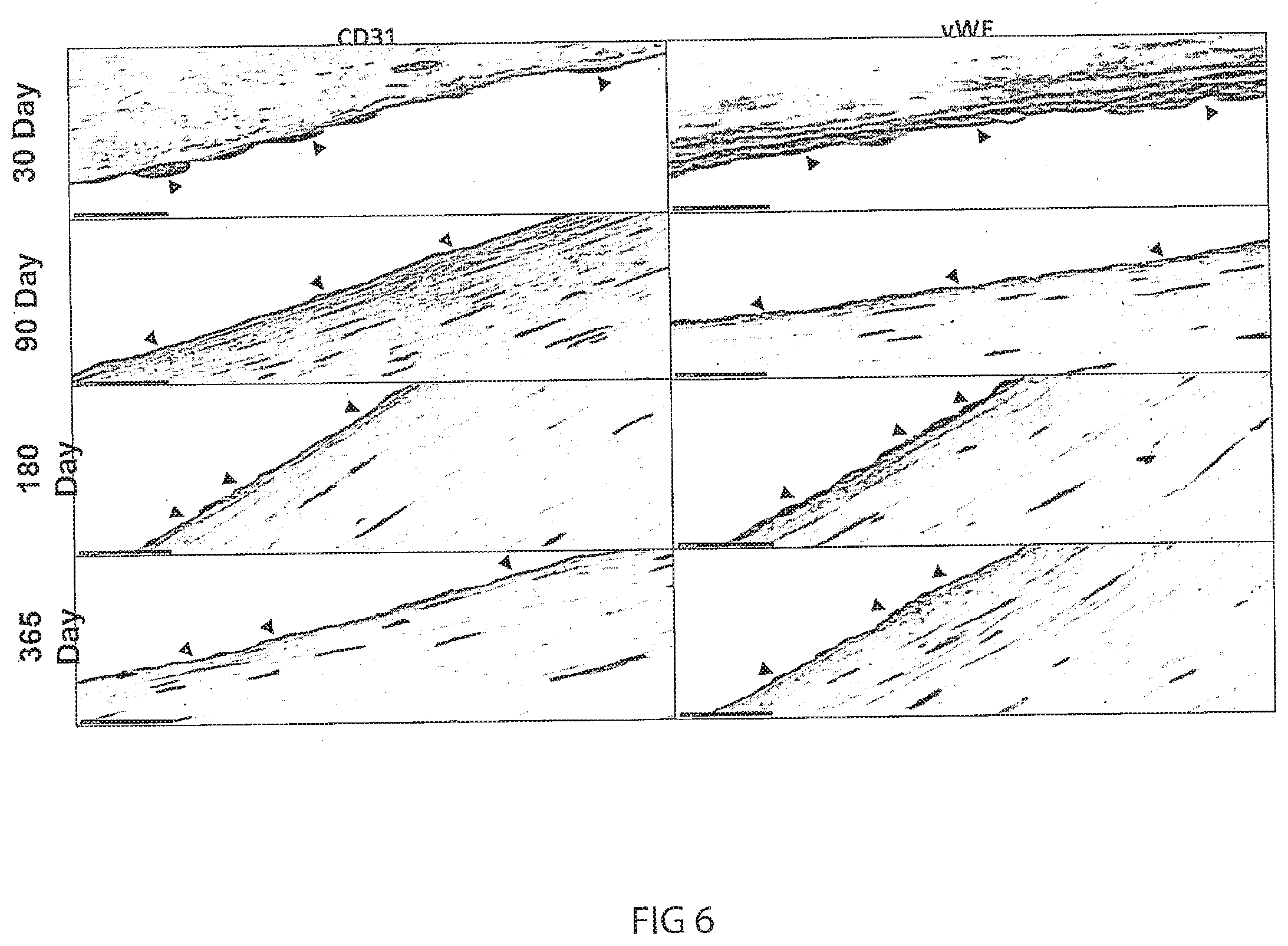 Patent US12472053 Figure 9 – Multiple layer vascular graft