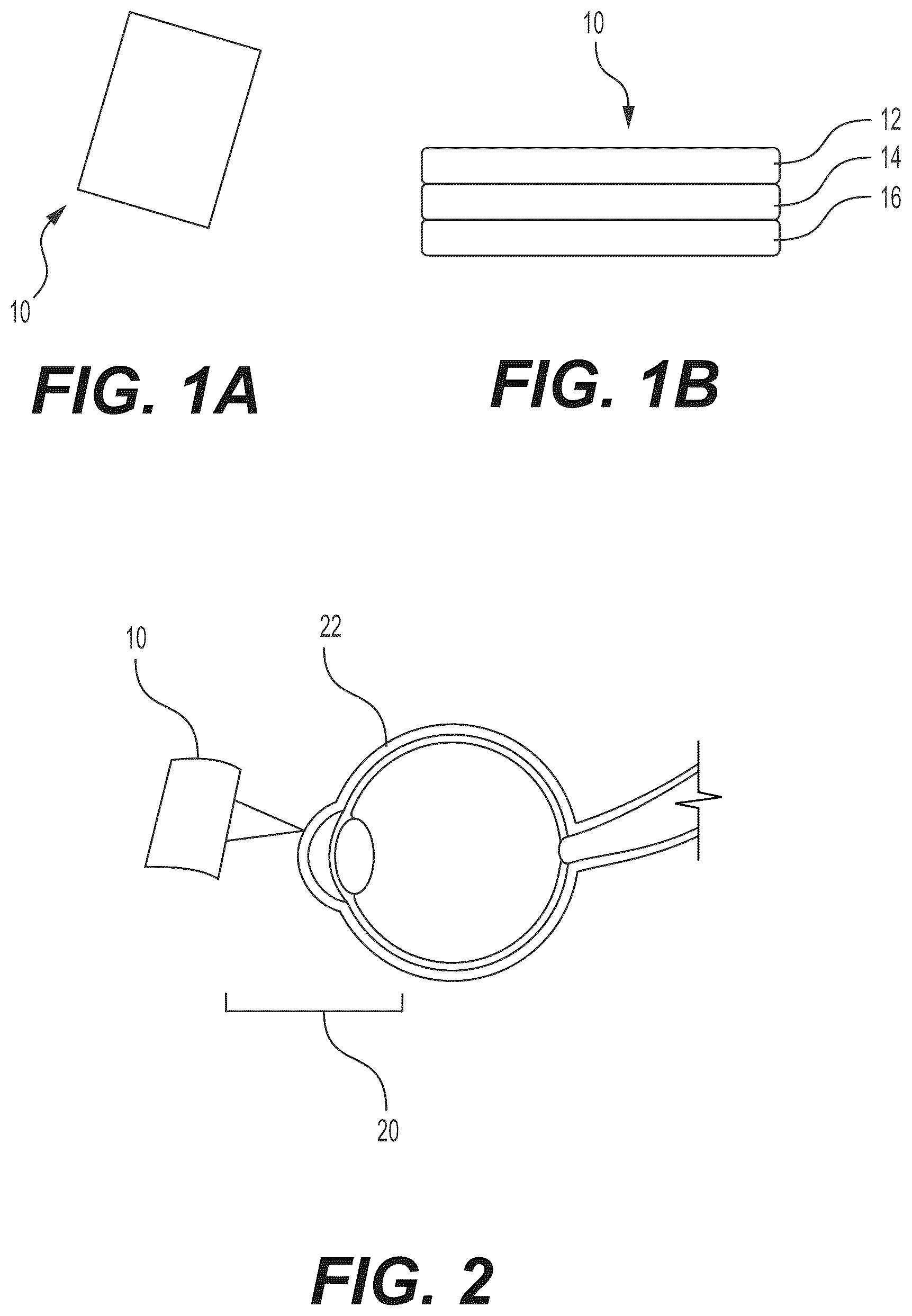 Patent US12472054 Figure 1 – Inductive matrix for functional ocular surface reconstruction